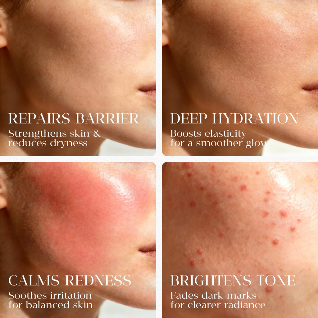 MATRÚM Organic Barrier Repair Face Oil — Deep Hydration & Redness Soothing