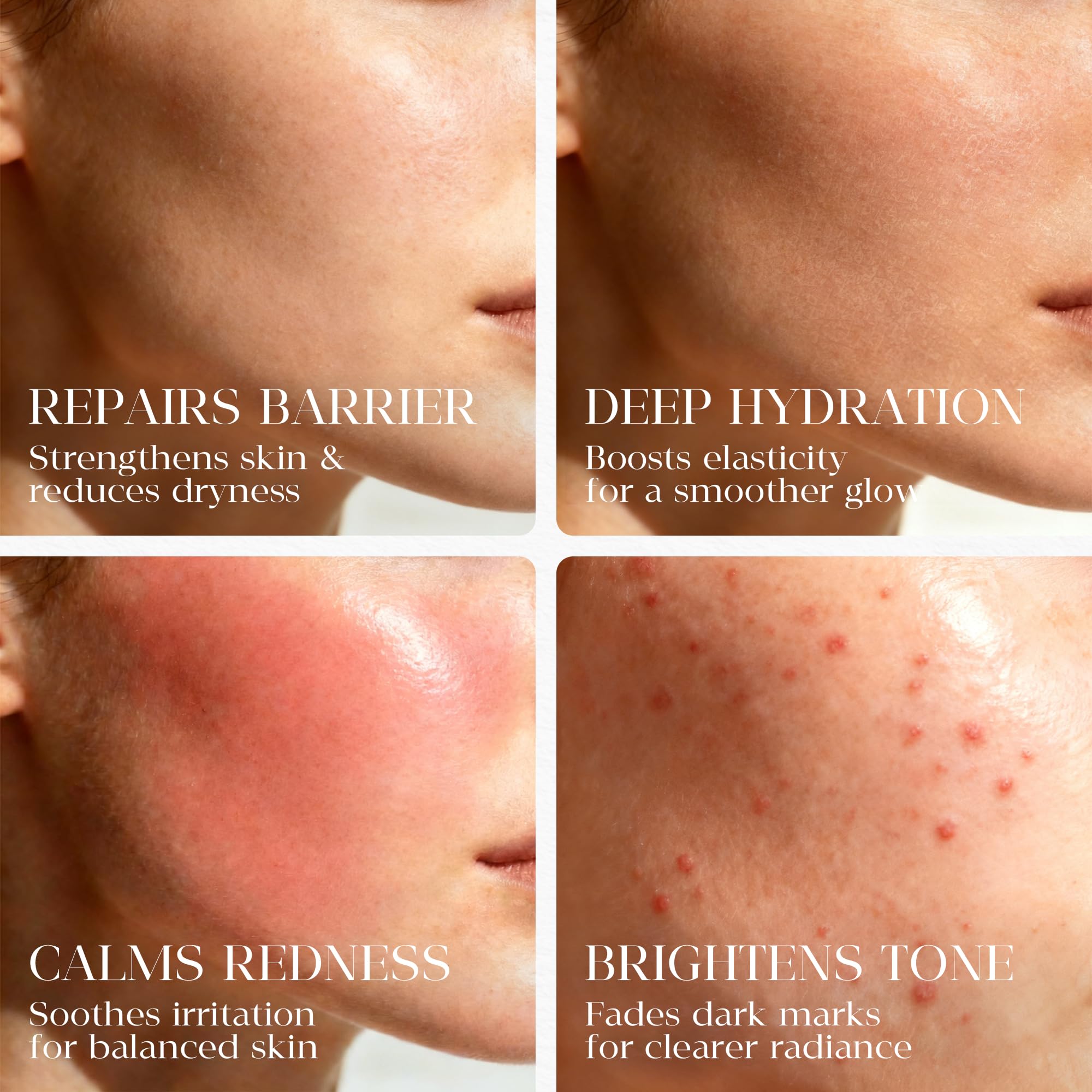 MATRÚM Organic Barrier Repair Face Oil — Deep Hydration & Redness Soothing