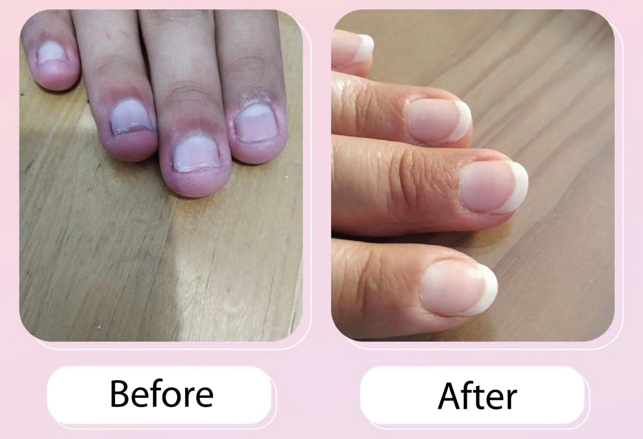 MAVALA Nailactan Nutritive Nail Cream for Damaged Nails – Nail Strengthener & Hardener | 0.5 oz