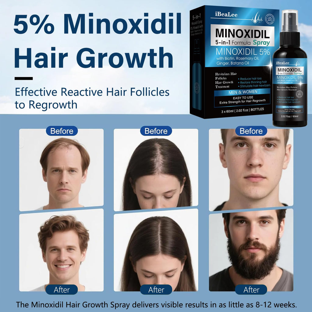 MAYFERTE 5% Minoxidil Hair Growth Spray for Men & Women – Biotin, Rosemary & Batana, 3 Bottles