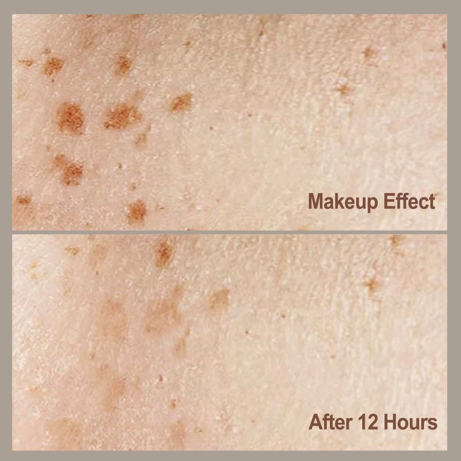 MAYKOO Freckle Stamp – Natural-Look Freckles Pen, Waterproof & Quick-Dry (Dark Brown)