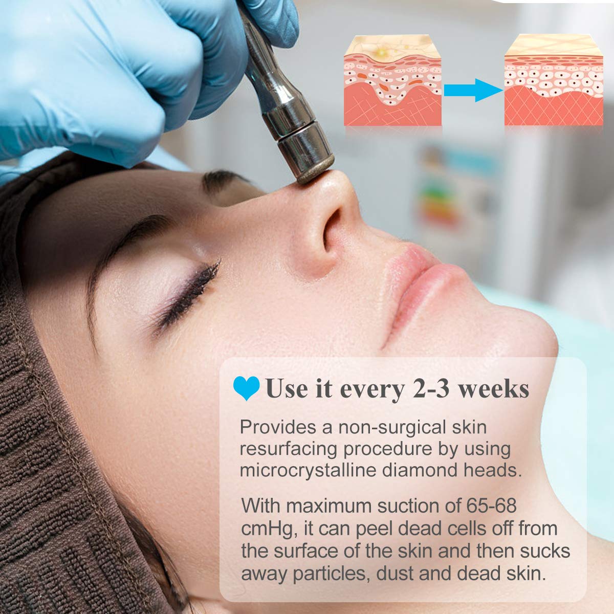 Mcwdoit Upgraded Diamond Microdermabrasion Machine – 65-68 cmHg Suction, Skin Rejuvenation, Lifting & Tightening
