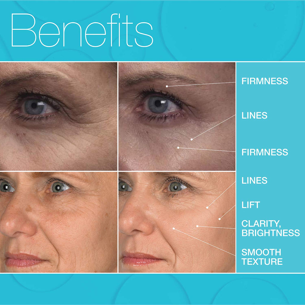 MD Complete Eye Wrinkle Duo – Retinol & Hyaluronic Rejuvenation Set