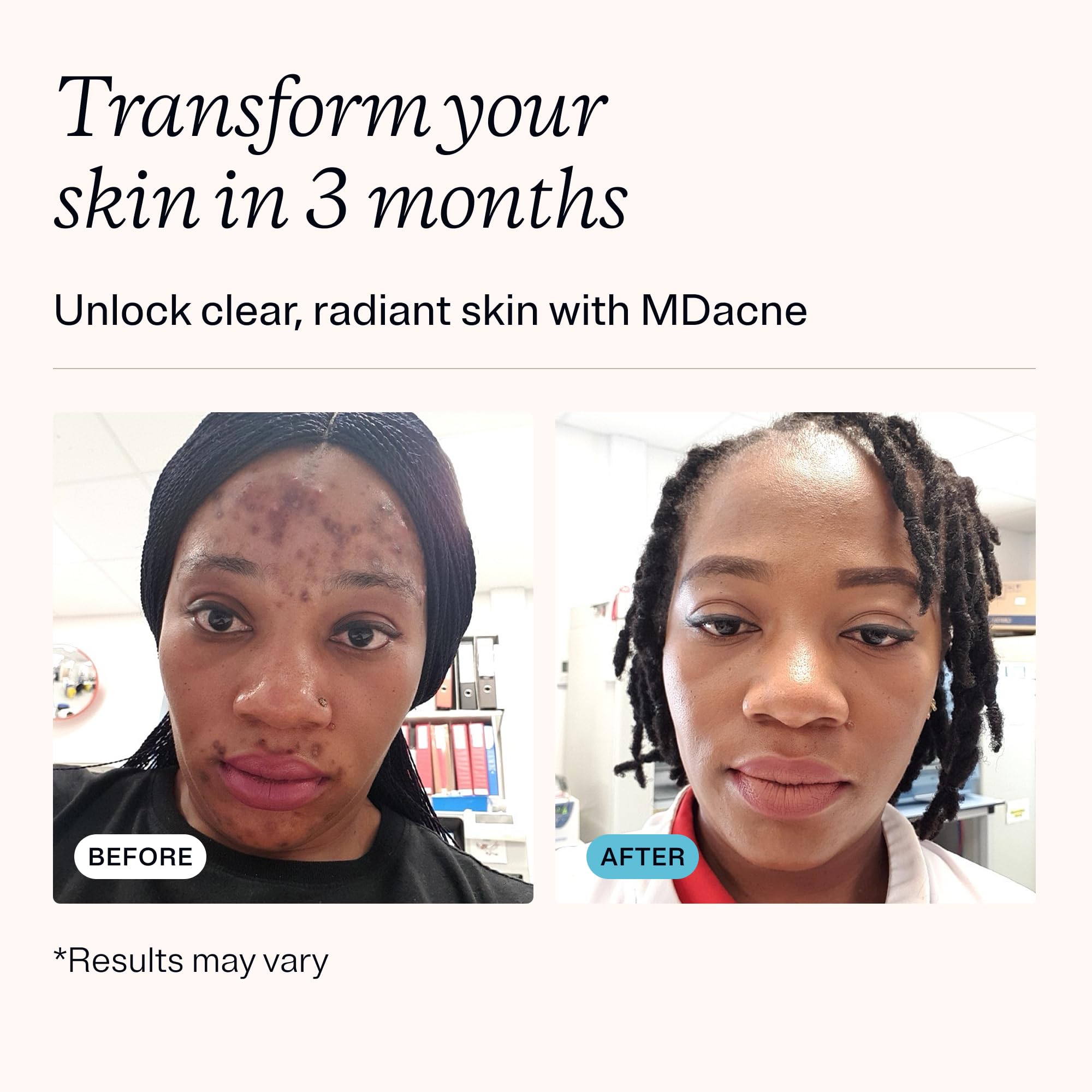 MDacne 3 Step Retinol Acne Kit — 0.25% Retinol, Salicylic Cleanser & Niacinamide Moisturizer