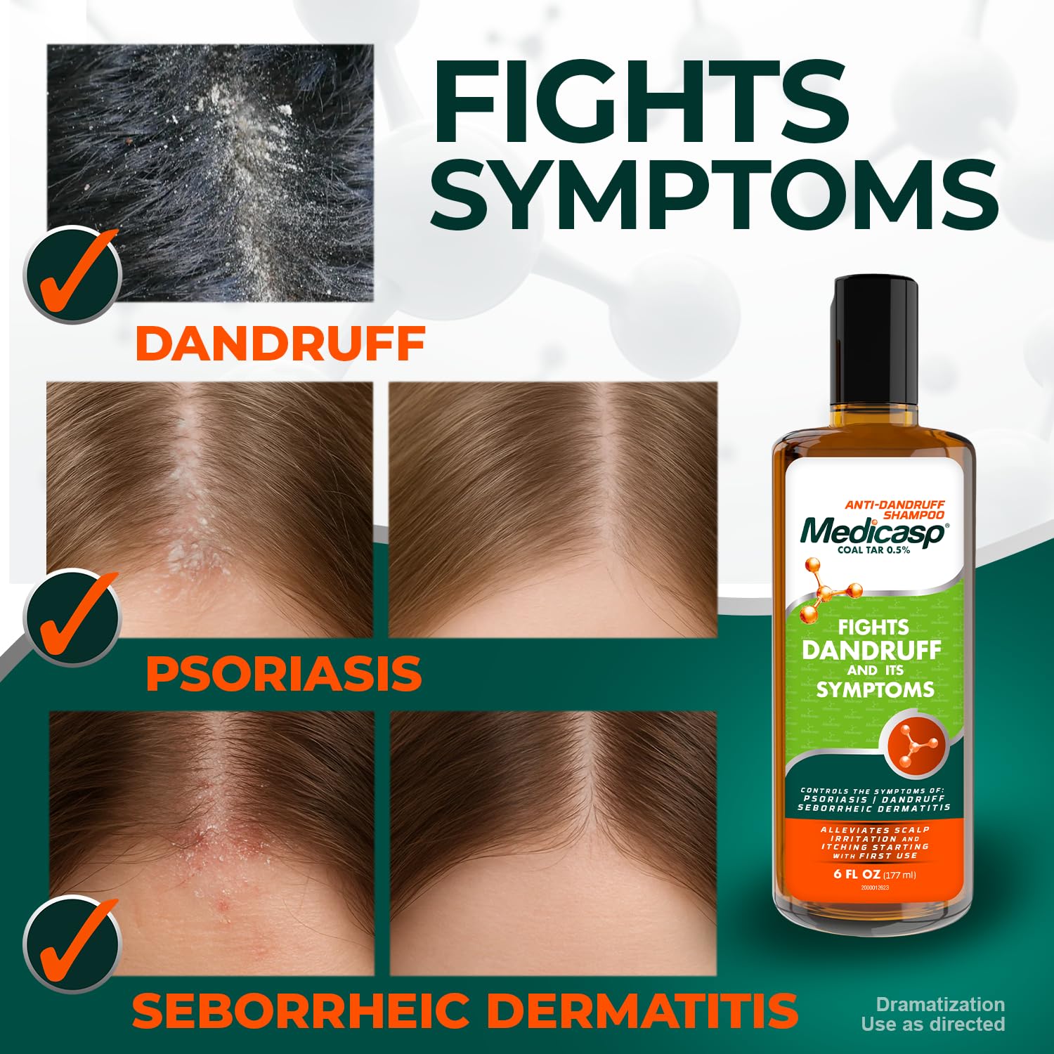 Medicasp Coal Tar Anti-Dandruff Shampoo - Starts Working from First Wash - 6 oz (3 Pack)