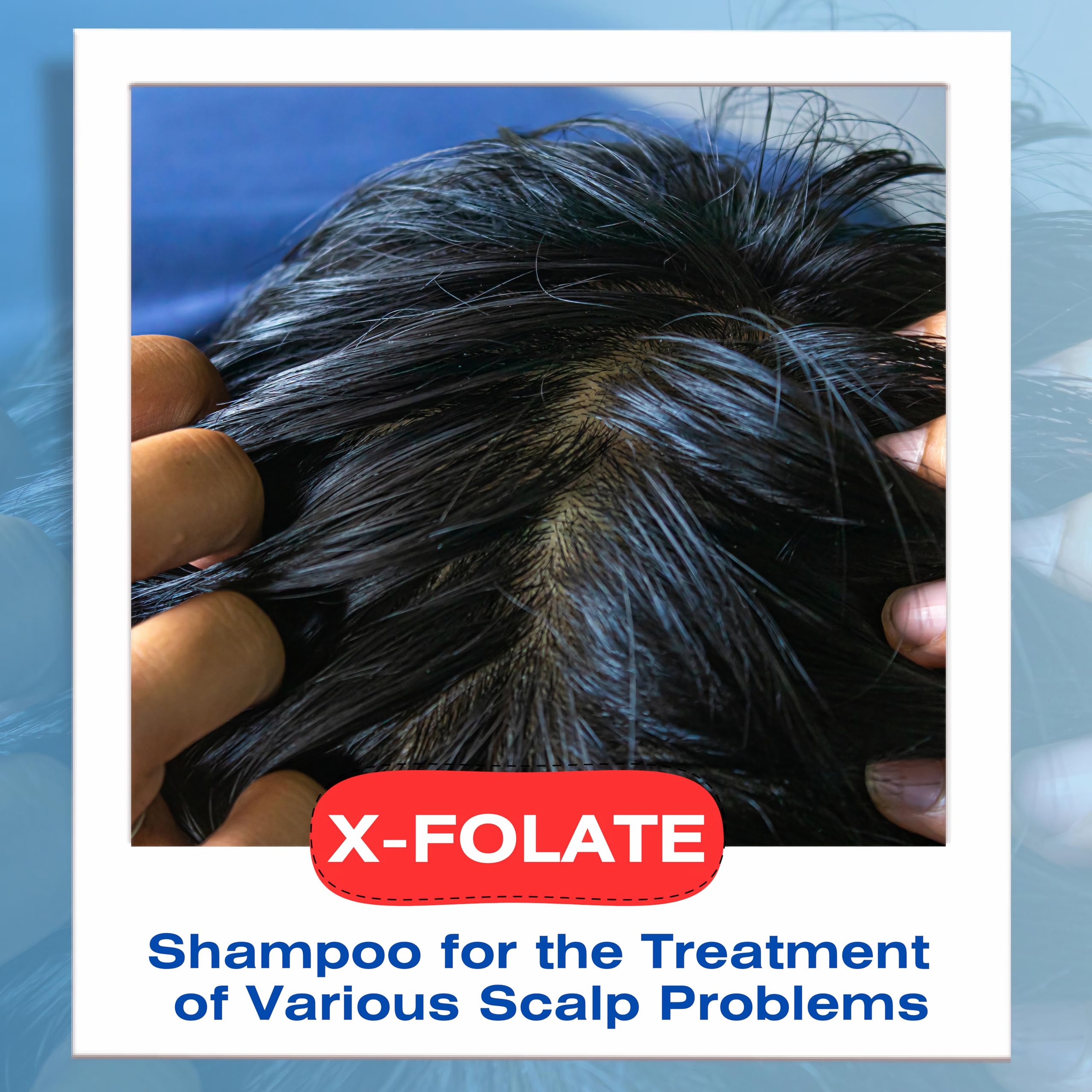 Mediceuticals X-Folate Shampoo – Anti-Dandruff Relief for All Hair Types, 8.45 oz