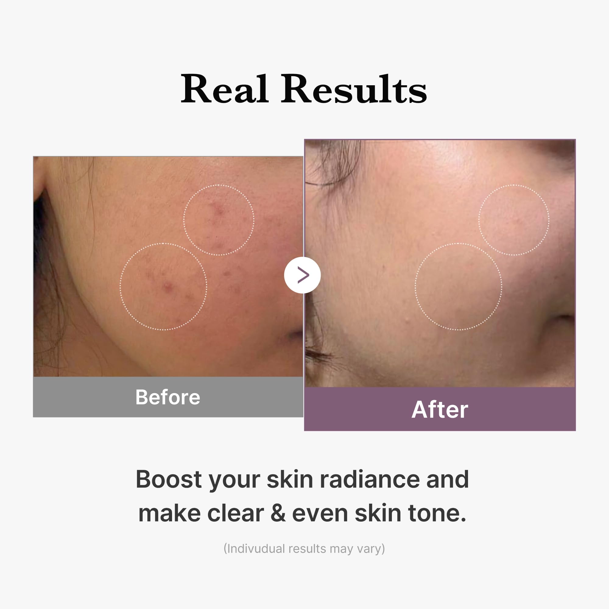 medicube Age-R Glutathione Glow Milky Toner – Glass Skin Hydration & Even Tone