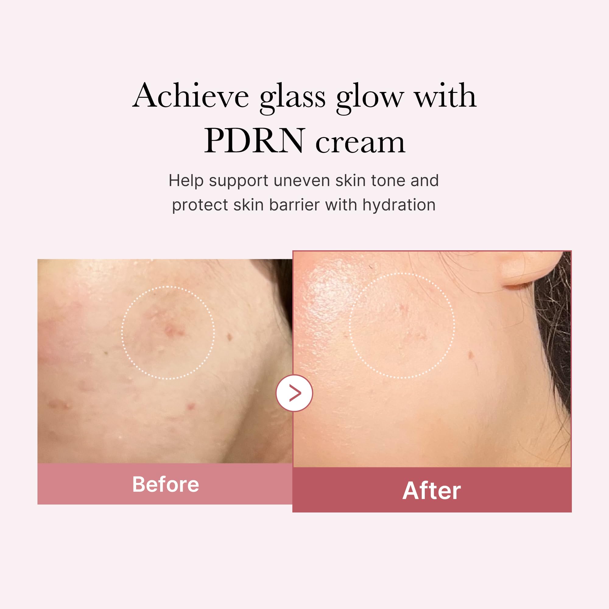 Medicube PDRN Pink Hyaluronic Moisturizing Cream | Hydration, Glow & Barrier Support | 50ml