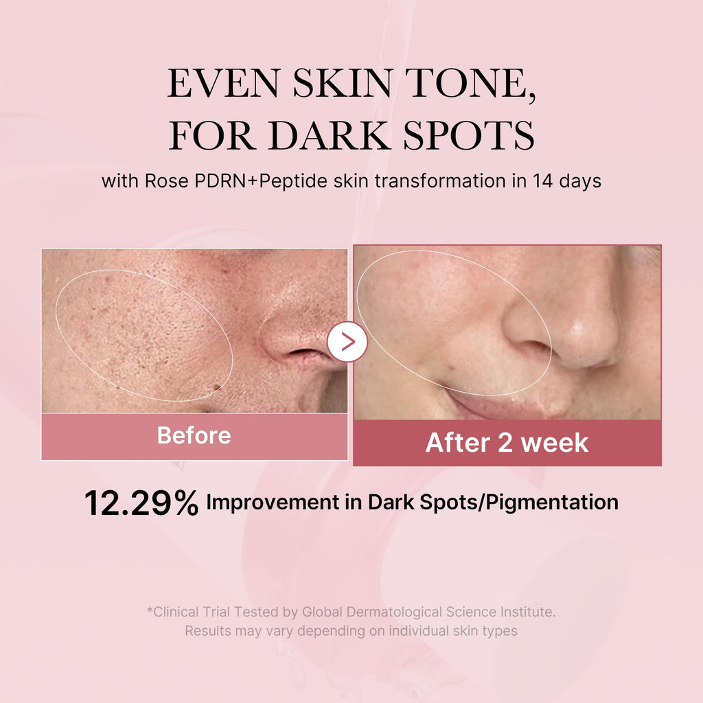 medicube PDRN Toner Rose – Lightweight Rose PDRN Peptide Toner for Radiant, Even Skin Tone | Korean Skincare