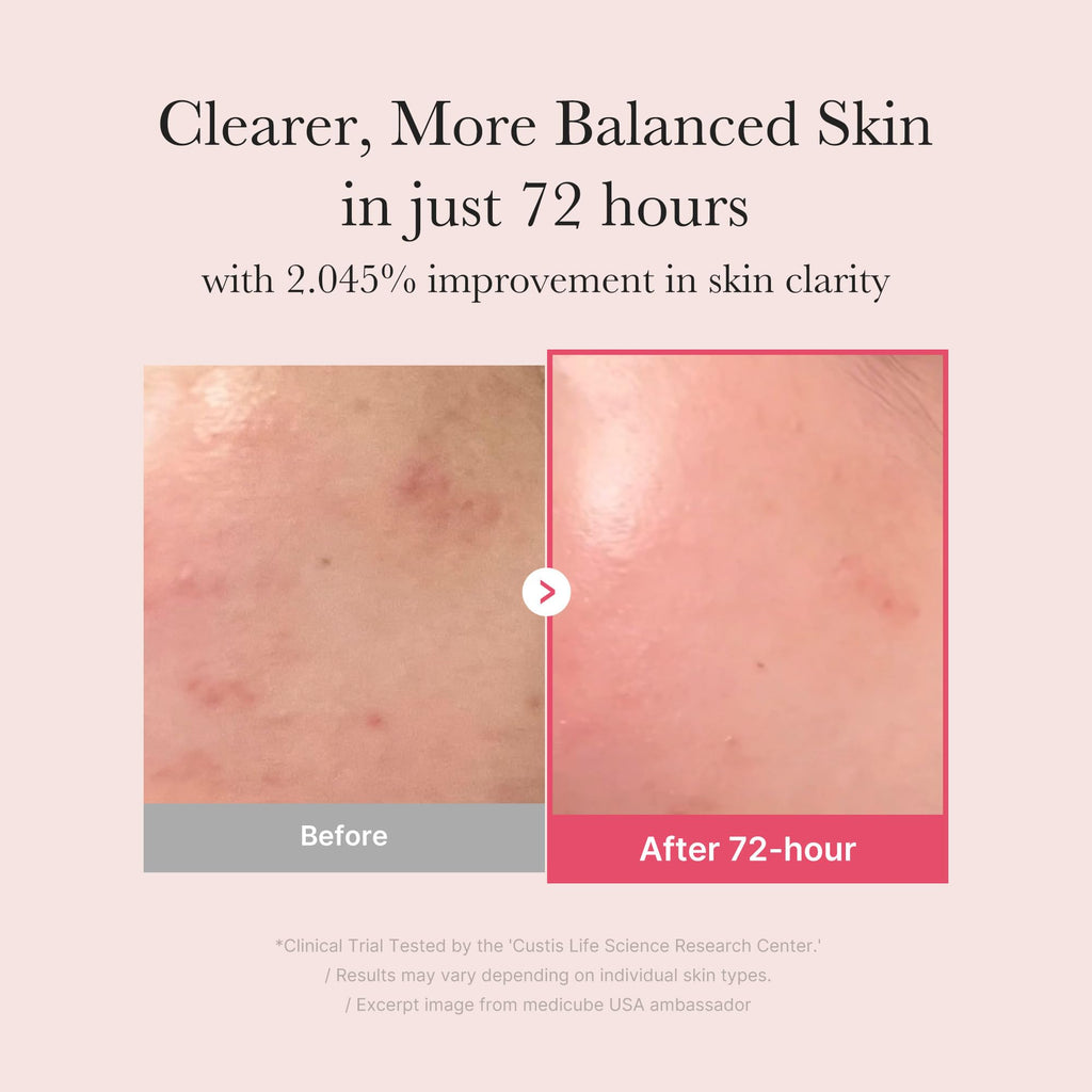 medicube TXA+Niacinamide 15% Glow Serum | After-Spot Care, Even Tone & Hydration | 1.01 fl oz