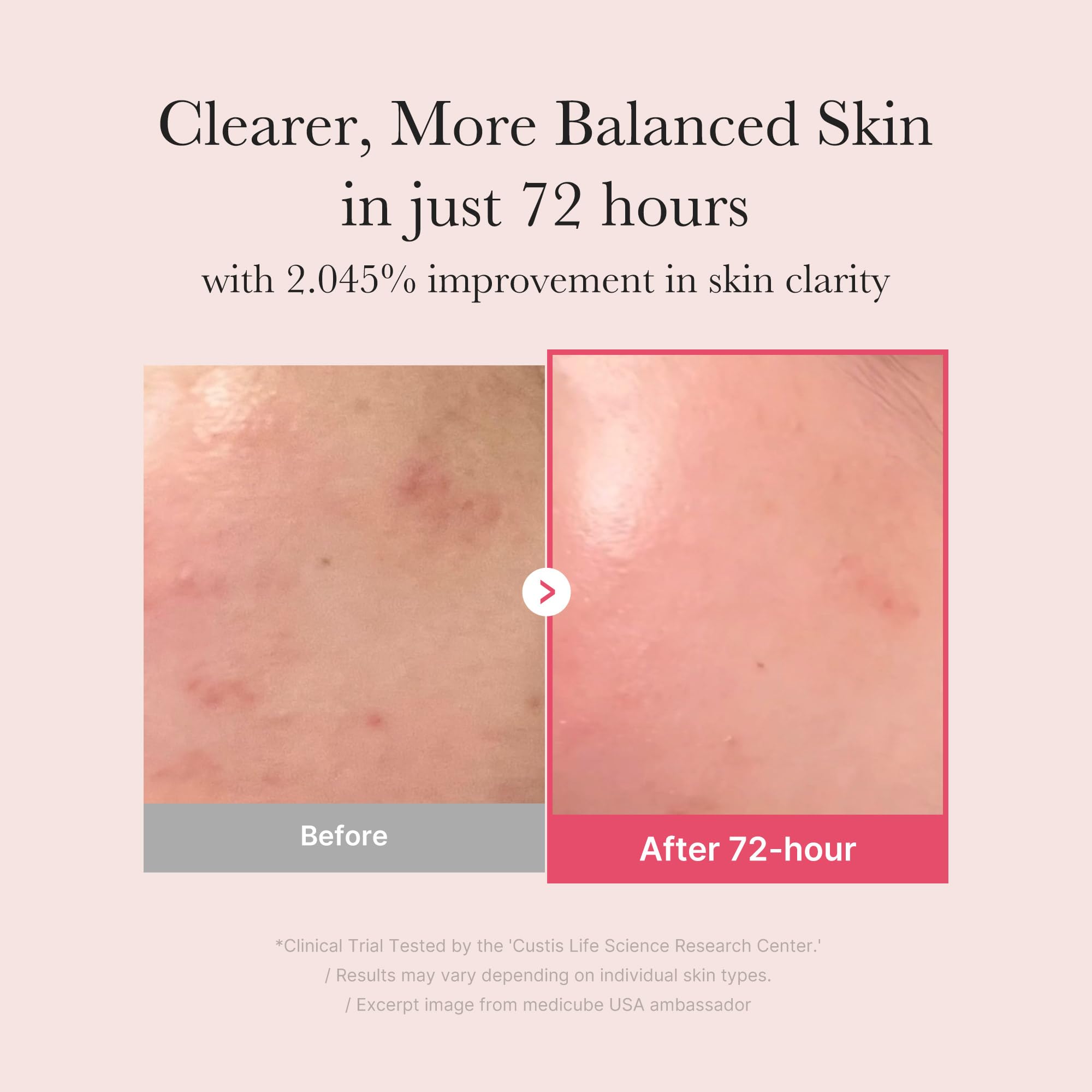 medicube TXA+Niacinamide 15% Glow Serum | After-Spot Care, Even Tone & Hydration | 1.01 fl oz