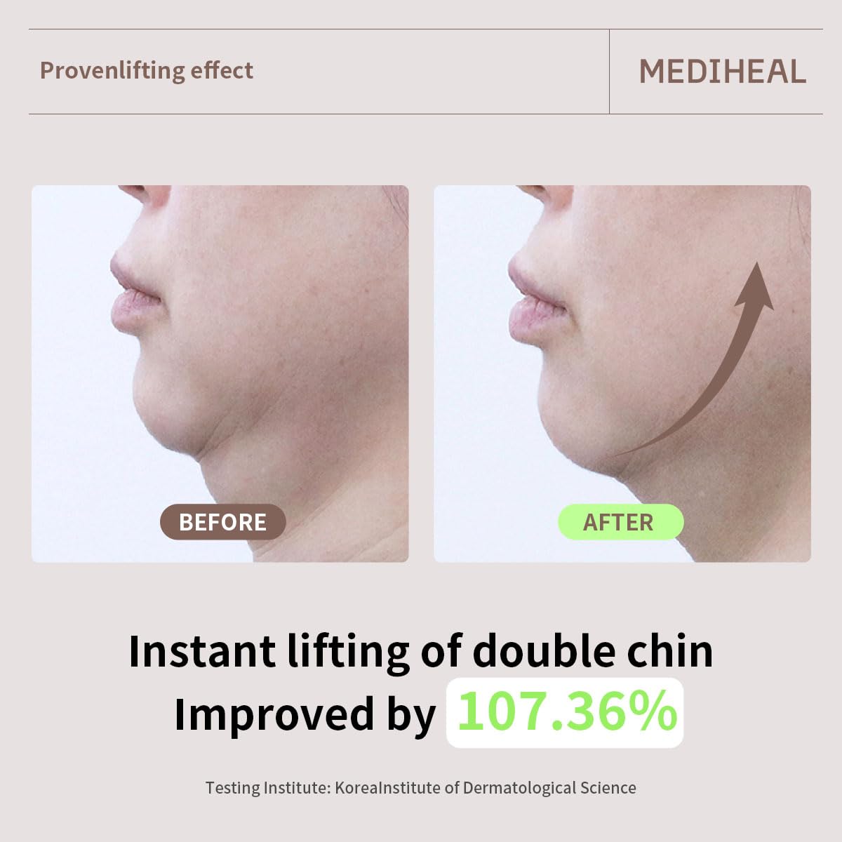 Mediheal Retinol Collagen Cream Lifting Mask – 10 Count | Firming, Anti-Aging Sheet Mask