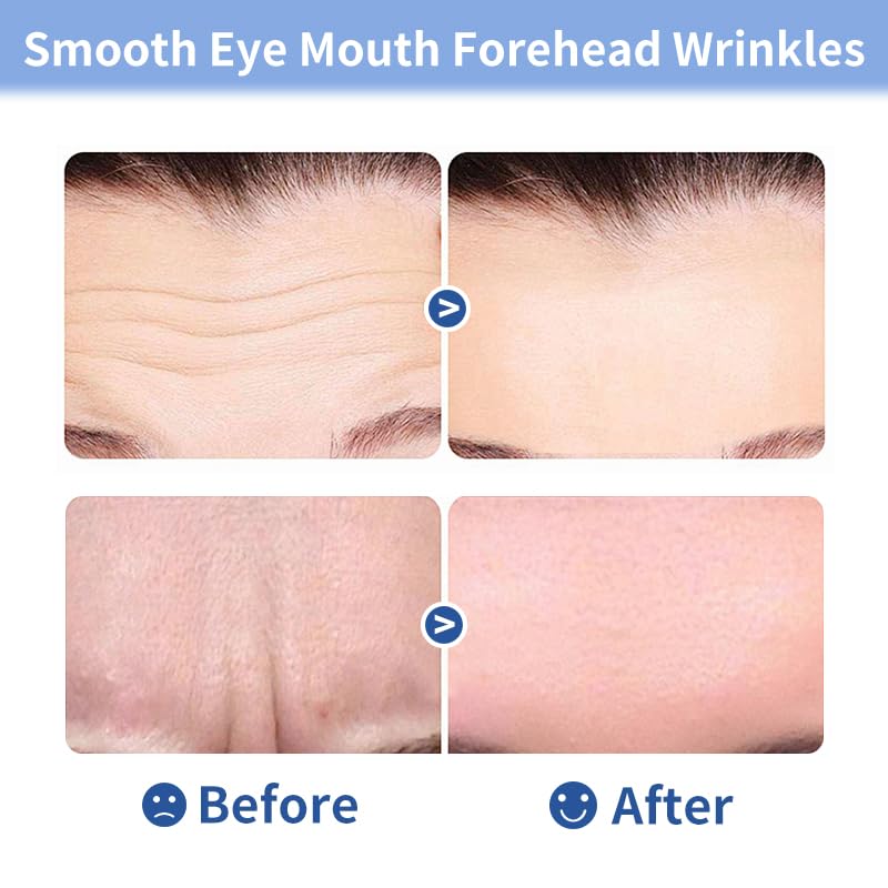 Medimama Collagen Forehead Patches – Anti-Wrinkle, Deep Hydration & Firming (Pack of 20)