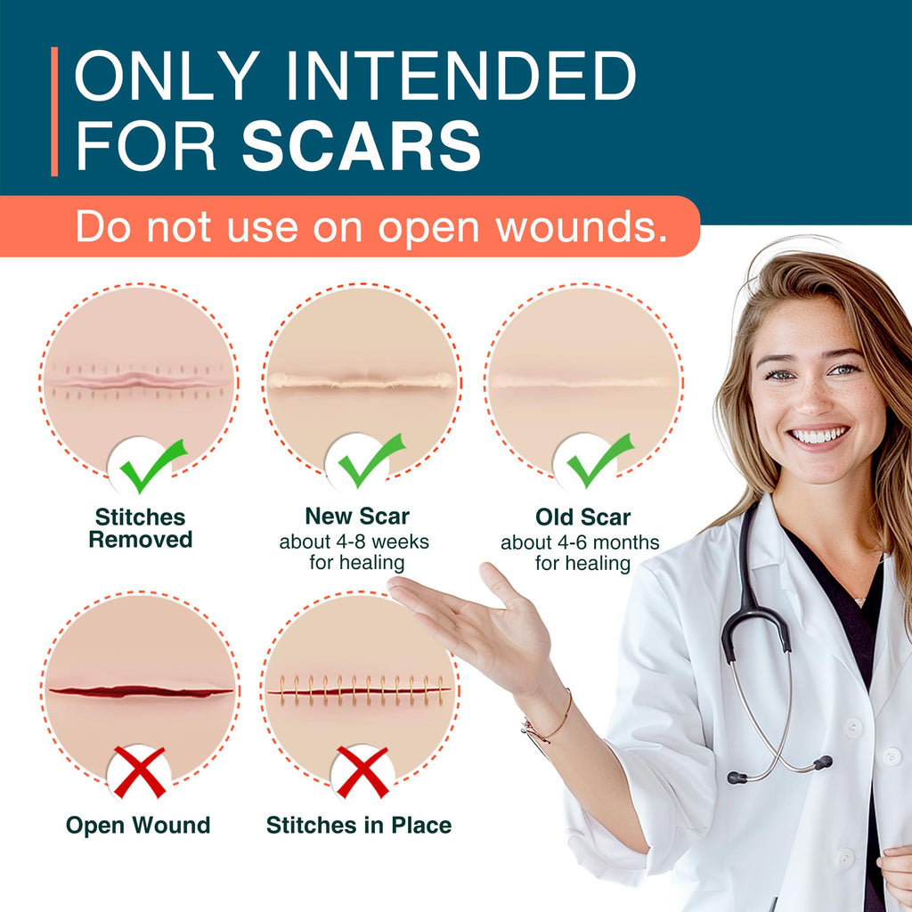 MEDLOT Silicone Scar Sheets 1.55” x 78” Roll – Reusable Scar Tape for Surgical & Skin Scars