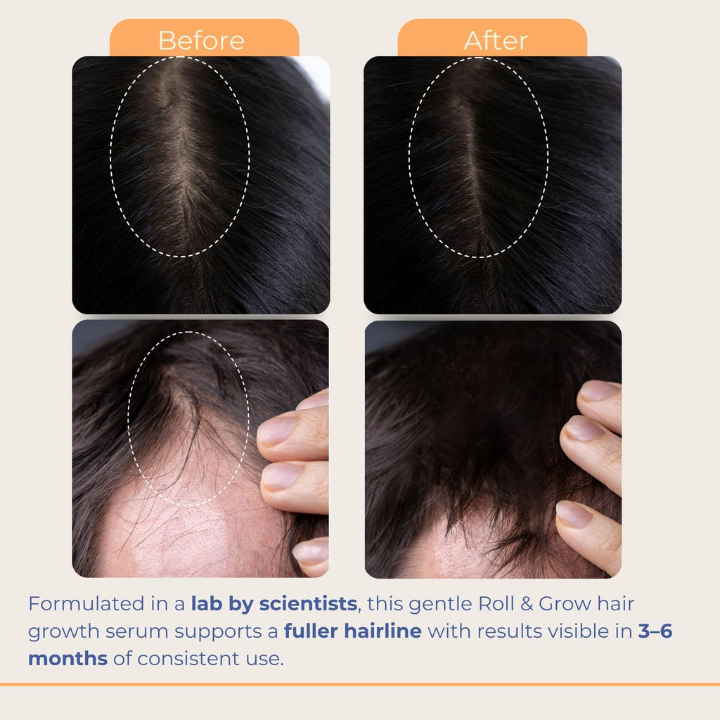 Medulla Clinic Hair Growth Serum Roll On – Made in EU, Batana, Rosemary & Biotin (1 fl oz)