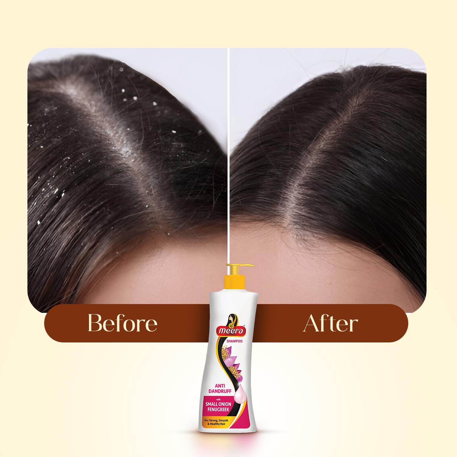 Meera Anti Dandruff Shampoo – White, 340ml | Gentle Cleansing for Scalp Comfort