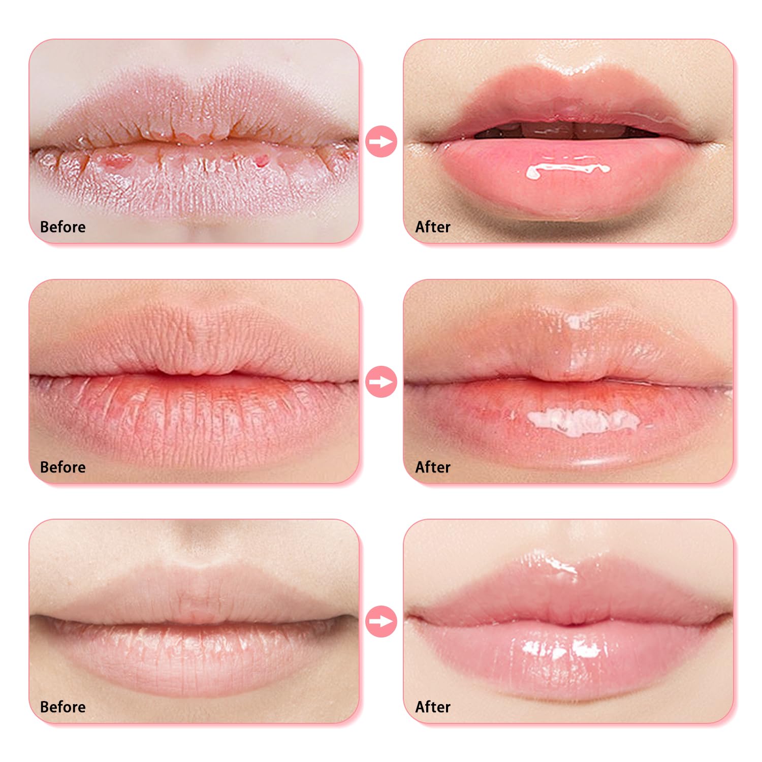 Meilury 3 Pcs Bee Lip Balm Honey Pot – Overnight Lip Mask Set (Honey, Strawberry, Watermelon)