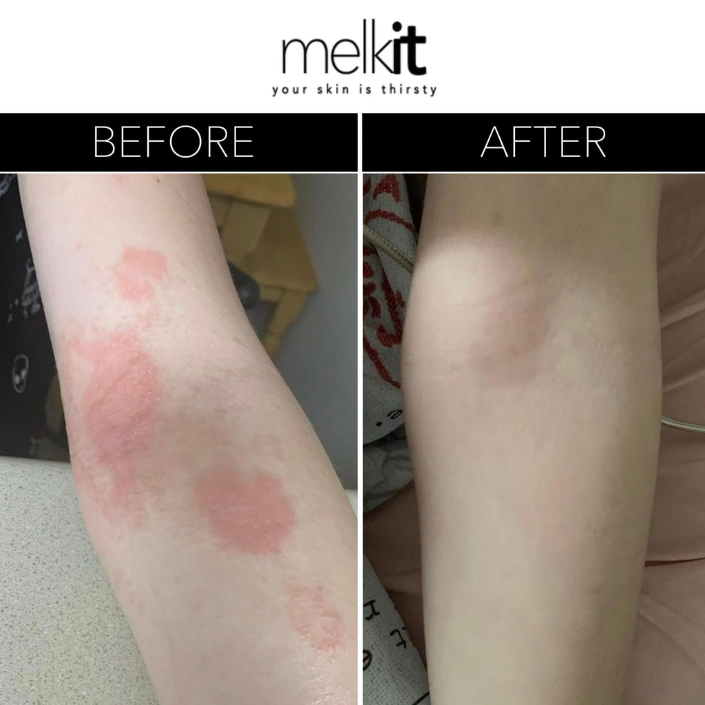 Melkit Body Melk Natural Body Cream – Fast-Absorbing Hydration for Dry & Sensitive Skin (16 oz)