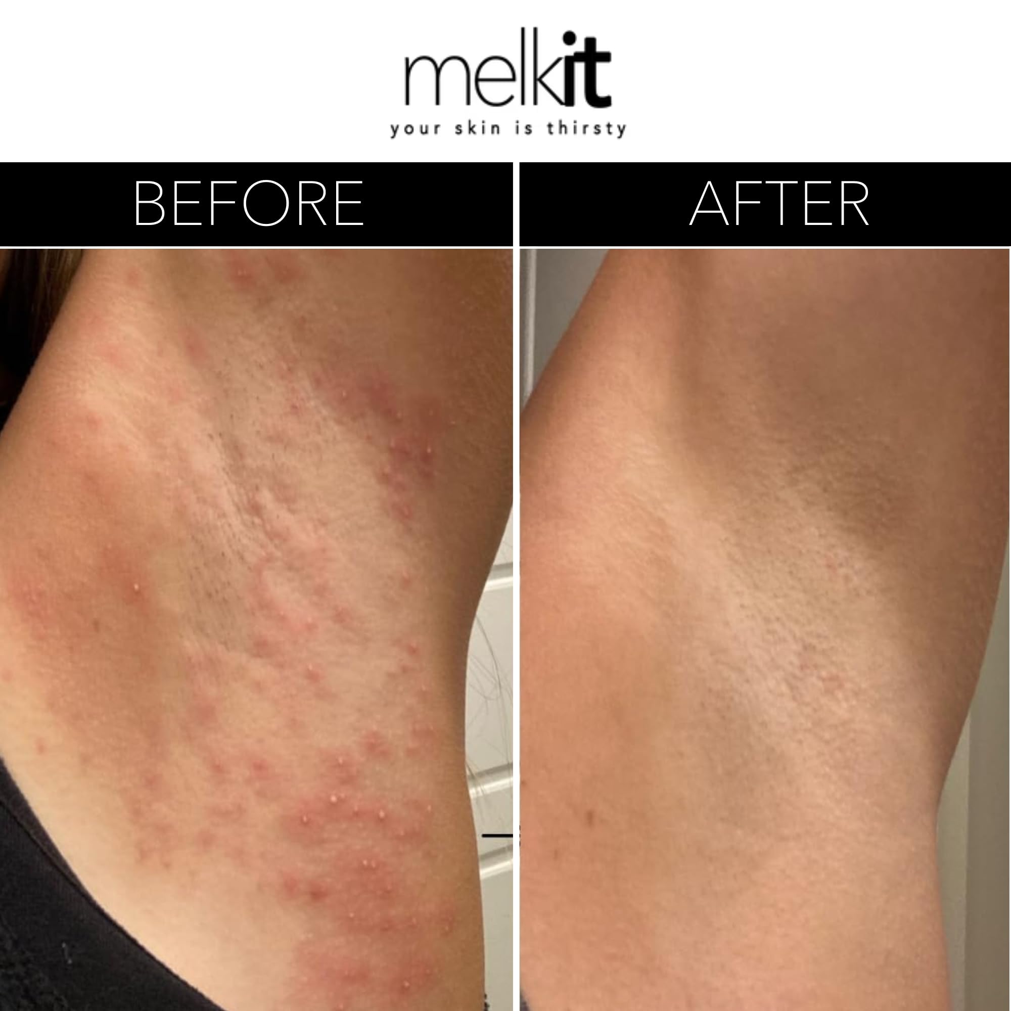 Melkit Body Melk Natural Body Cream – Fast-Absorbing Hydration for Dry & Sensitive Skin (16 oz)