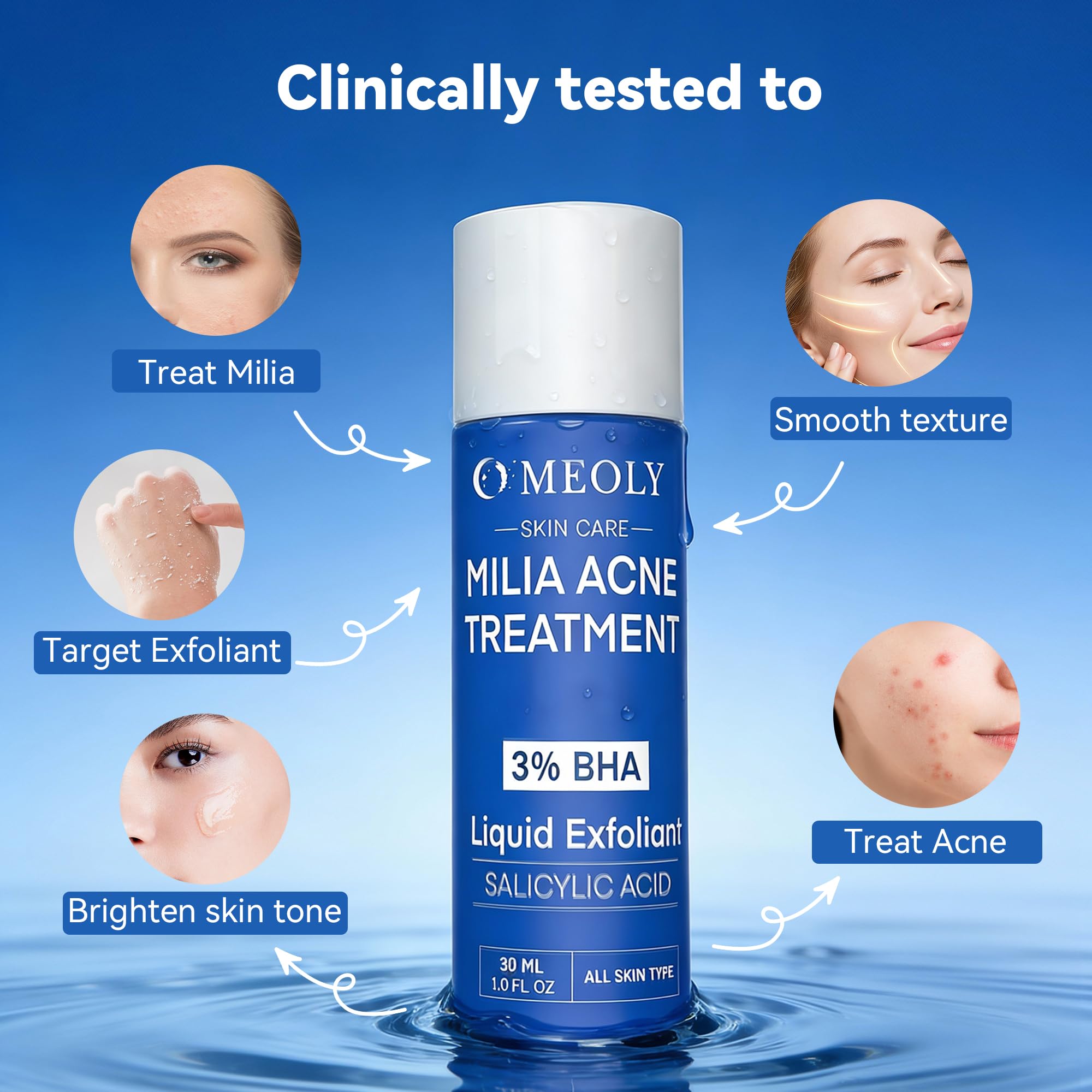 MEOLY Milia Remover with Salicylic Acid – Milia Spot Treatment for Eyes & Face | 30 ml