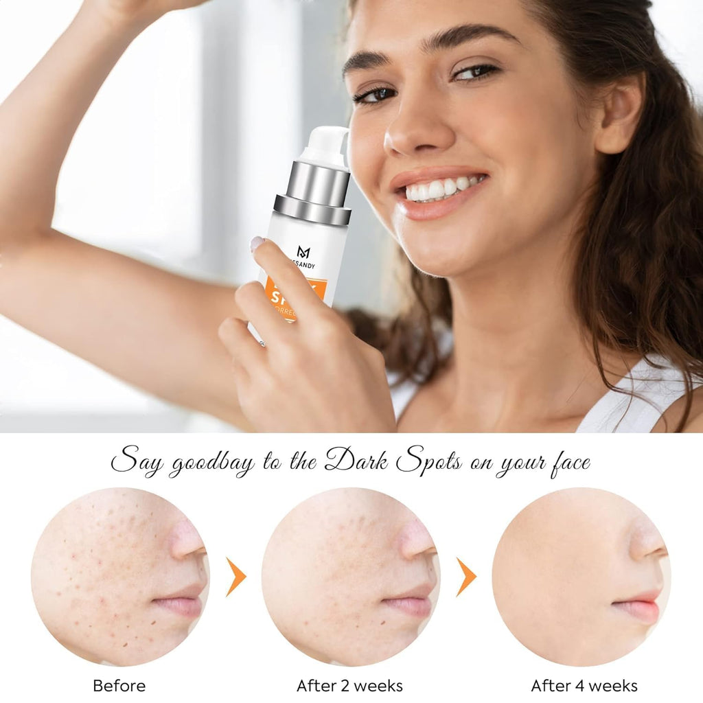 MESANDY Dark Spot Serum for Face – Brighten Sun Spots & Uneven Tone