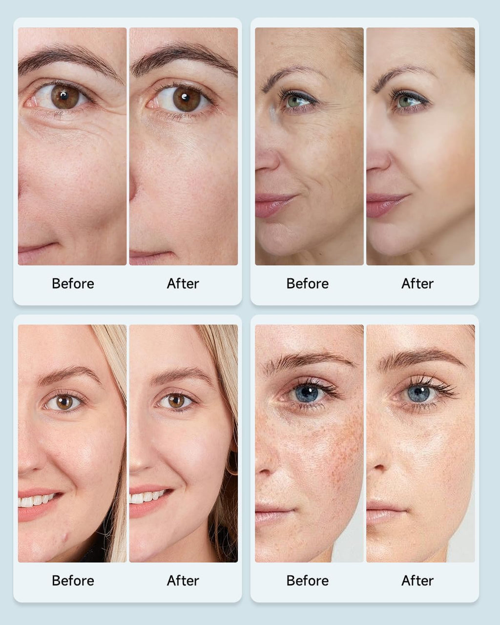 MIBIITTY Beauty LED Mask – LED Light Therapy for Skin
