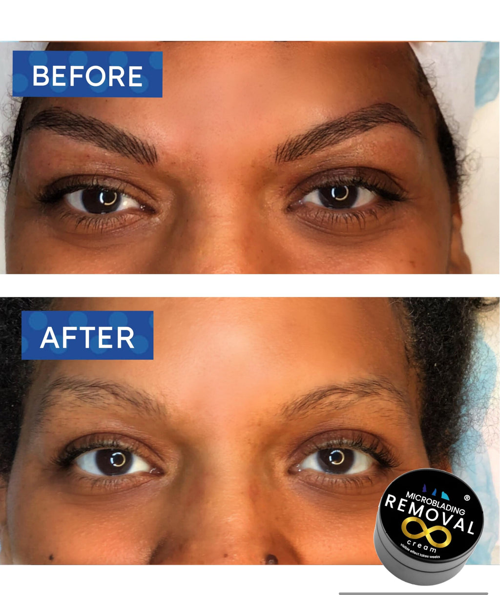 Microblading Removal Cream - Eyebrow Pigment Color Correction, 1.5 fl oz