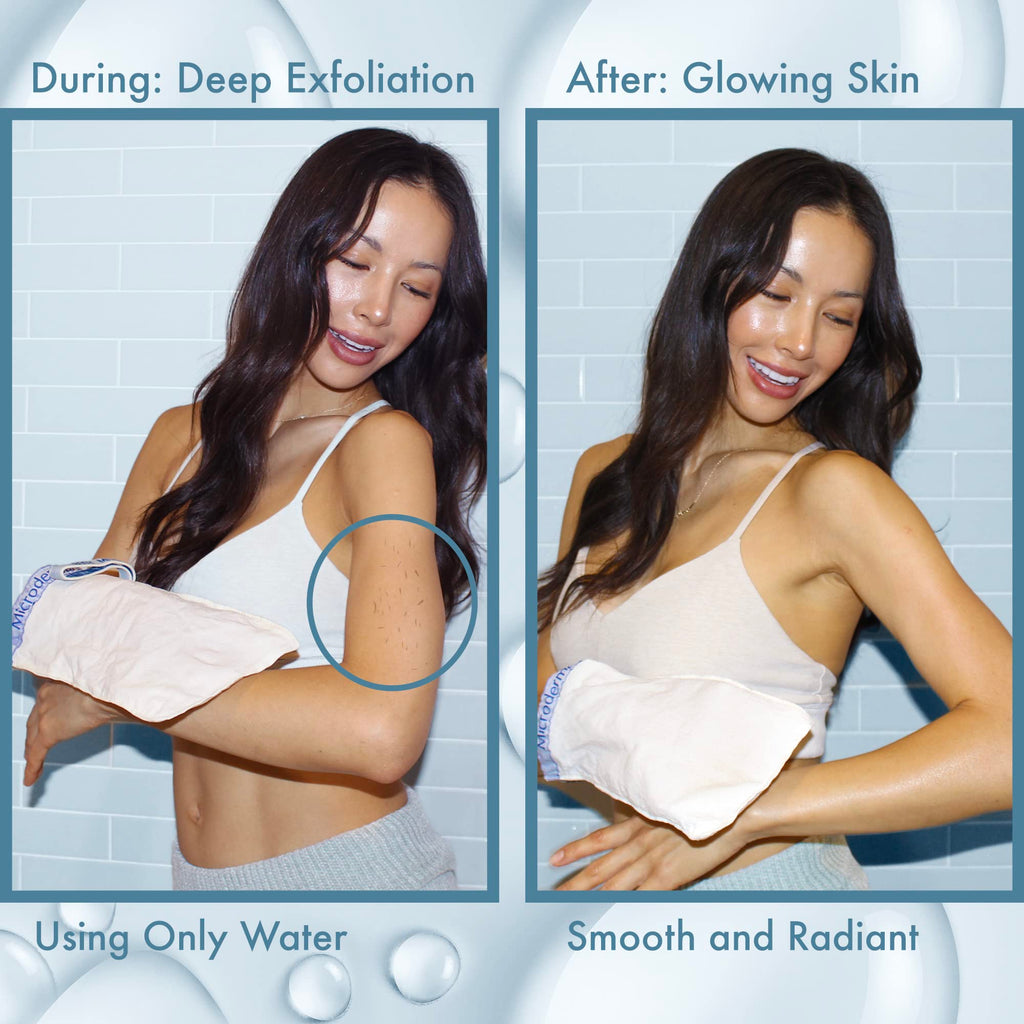 MicrodermaMitt Original Deep Exfoliating Mitt for Body | Premium Turkish Kessa Glove