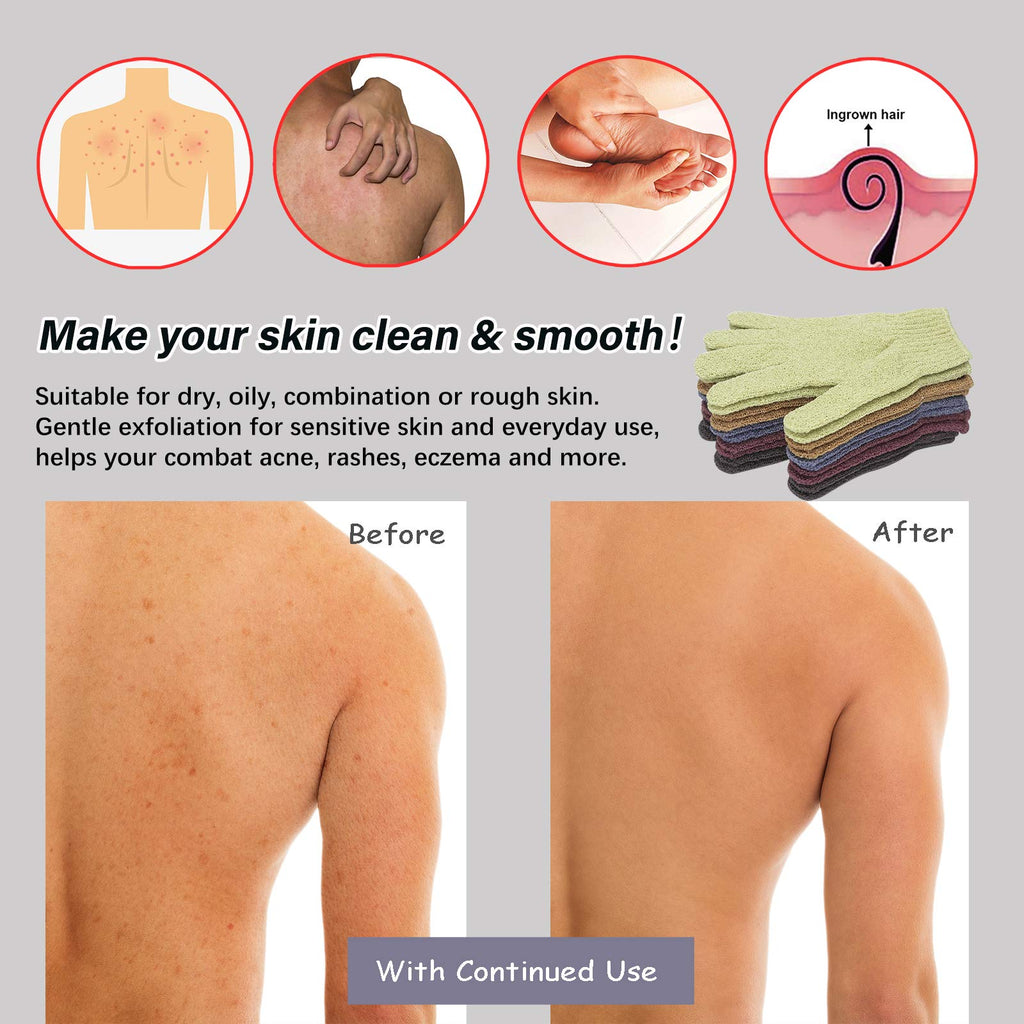 MIG4U Shower Exfoliating Scrub Gloves – 5 Color Pack for Deep Cleansing & Skin Refresh