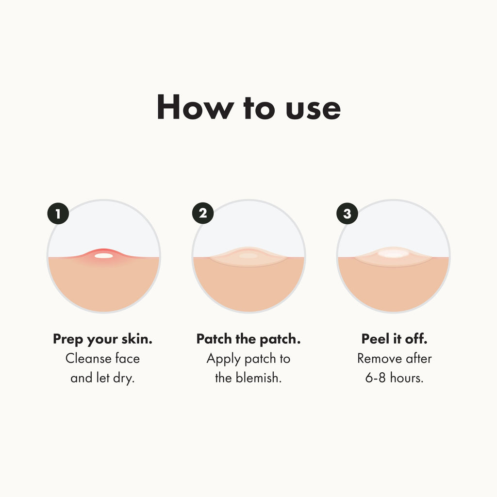 Mighty Patch Original – Hydrocolloid Acne Patch by Hero Cosmetics, 72 Count