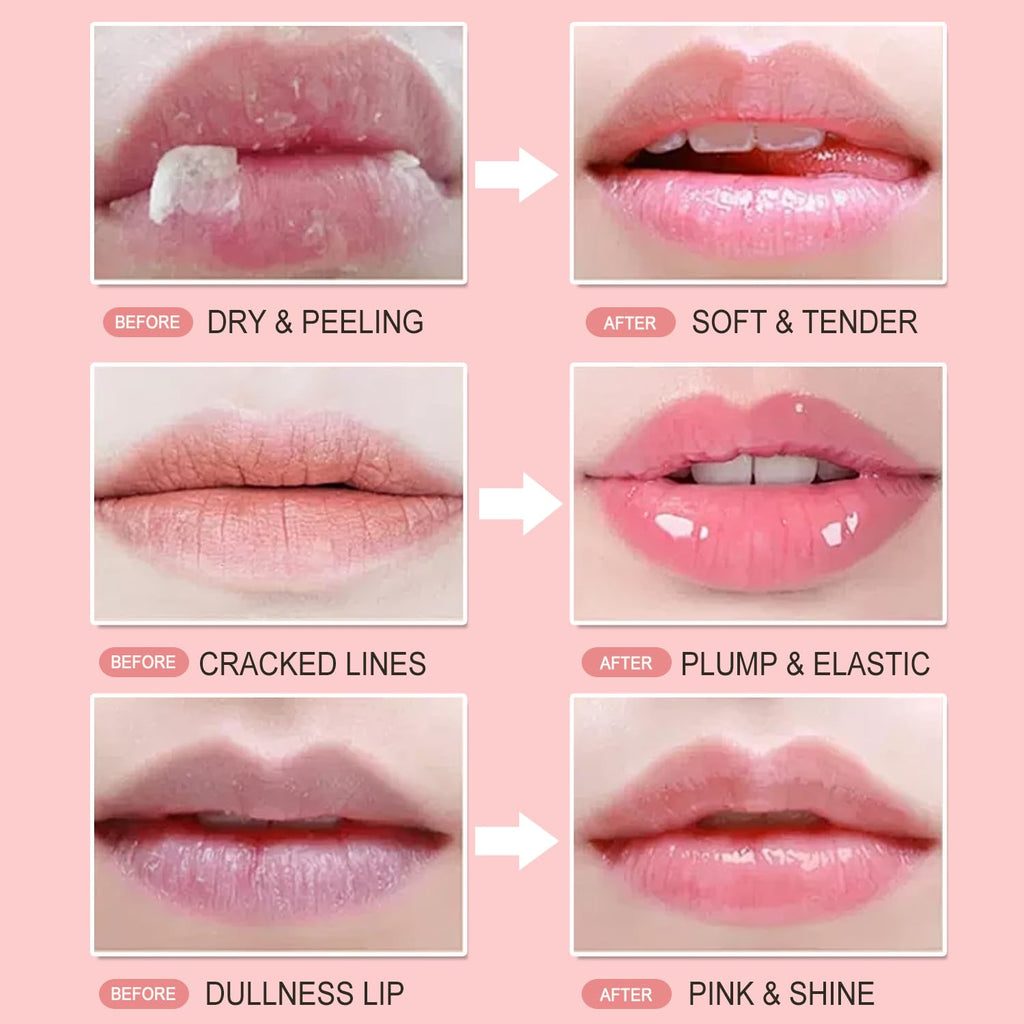 Miniling 4-Pack Bee Lip Balm Honey Pot – Hydrating Lip Mask & Exfoliating Lip Scrub
