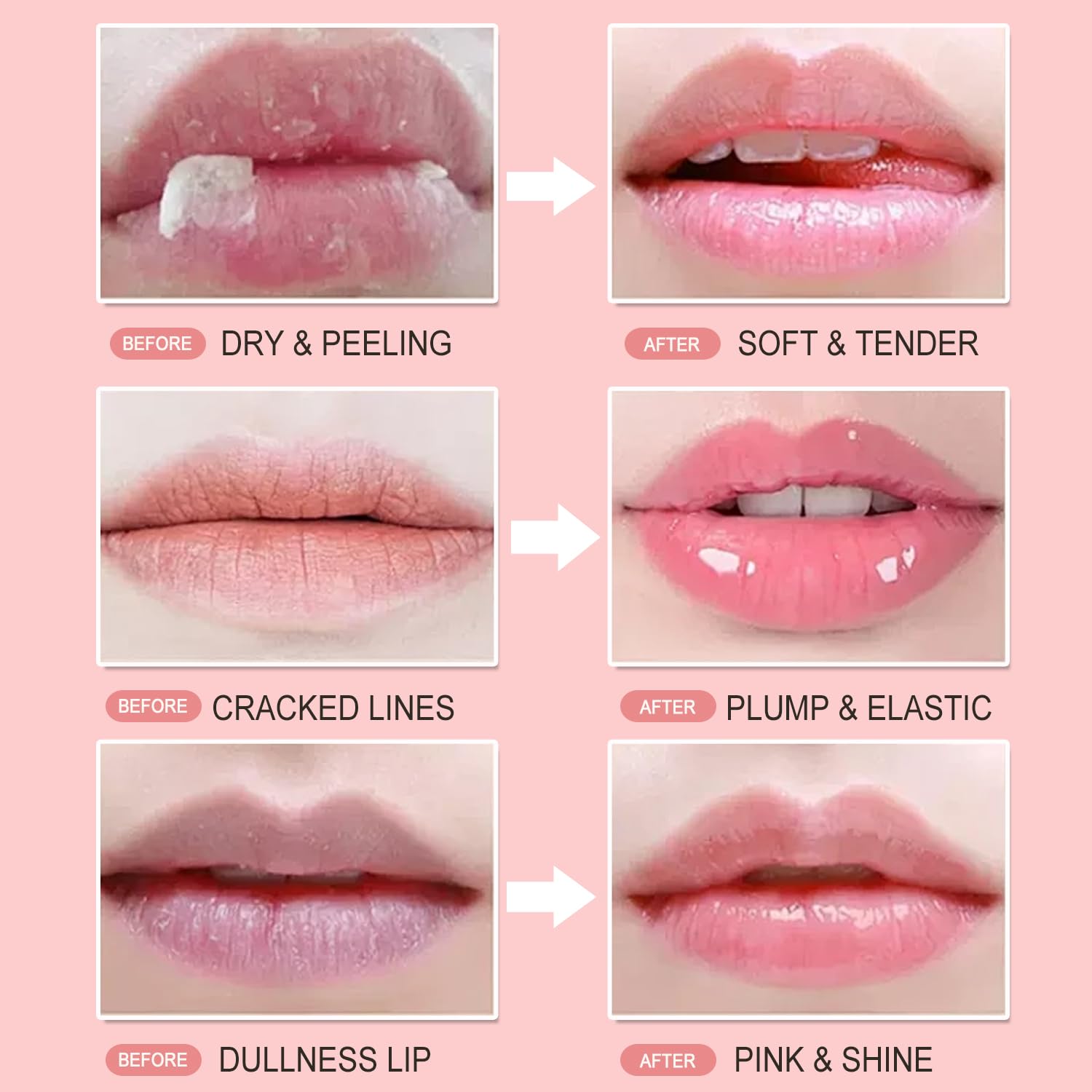 Miniling 4-Pack Bee Lip Balm Honey Pot – Hydrating Lip Mask & Exfoliating Lip Scrub