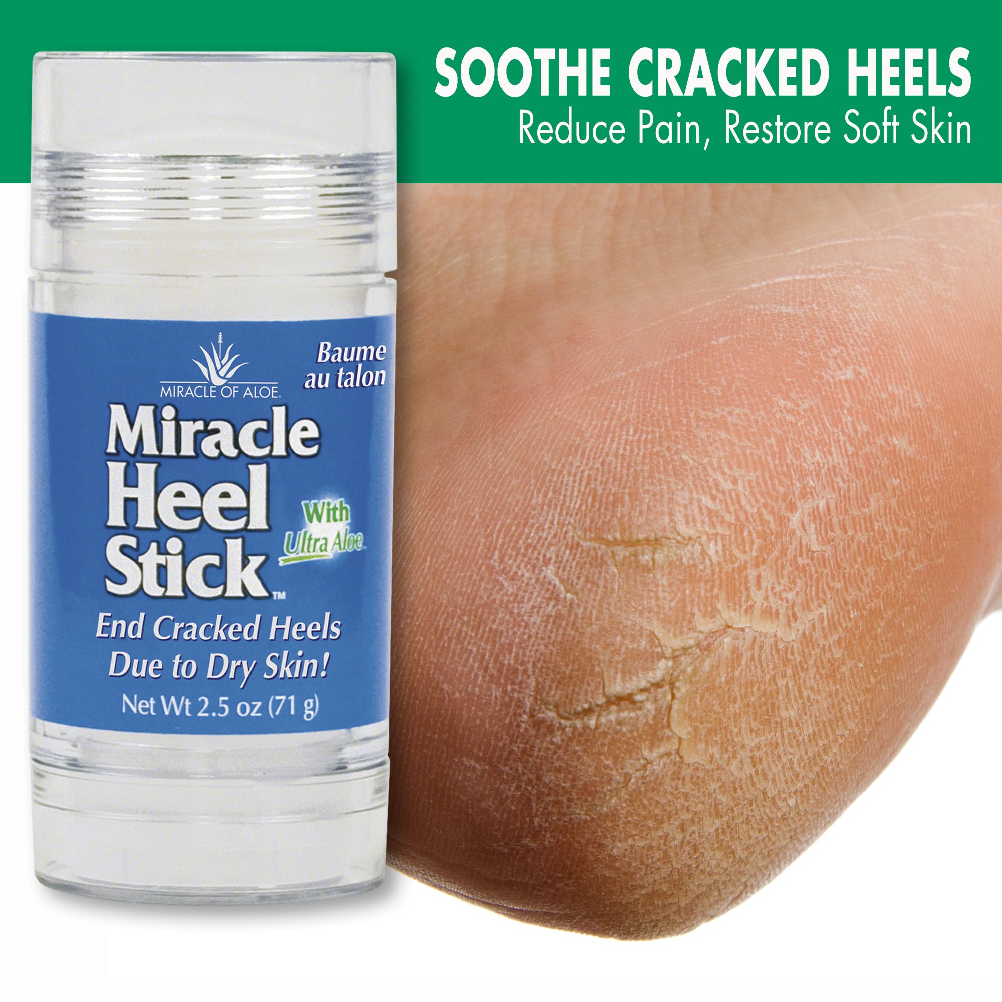 Miracle of Aloe Heel Stick – Dry Cracked Heel Balm (2.5 oz) with Pure Aloe Vera