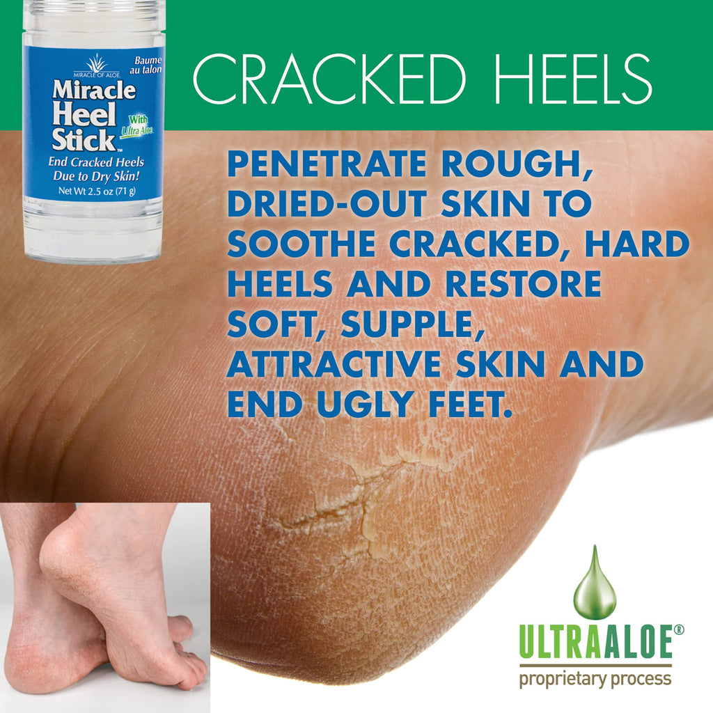Miracle of Aloe Heel Balm & Foot Repair Cream – Ultra Aloe Moisturizing Duo for Dry, Cracked Feet