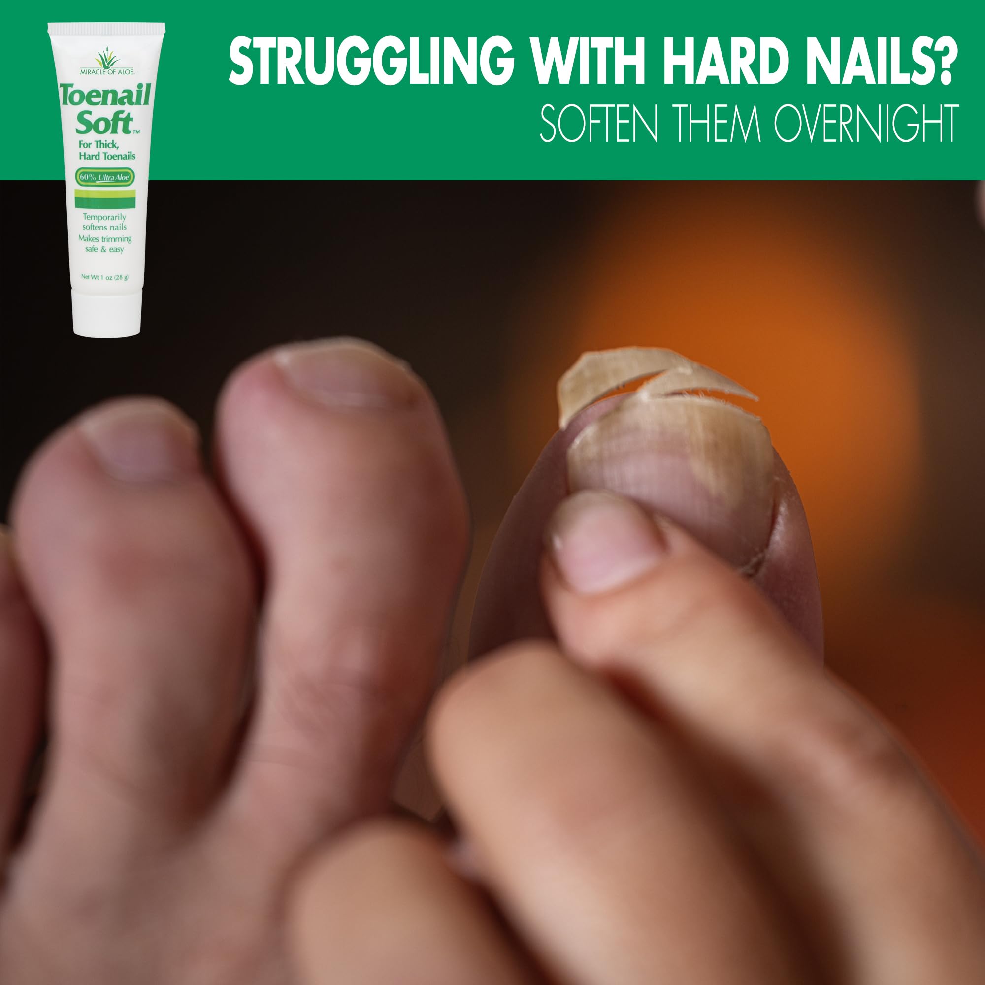 Miracle of Aloe Toenail Softener Cream – Fast-Acting, Non-Greasy, Safe for All Ages