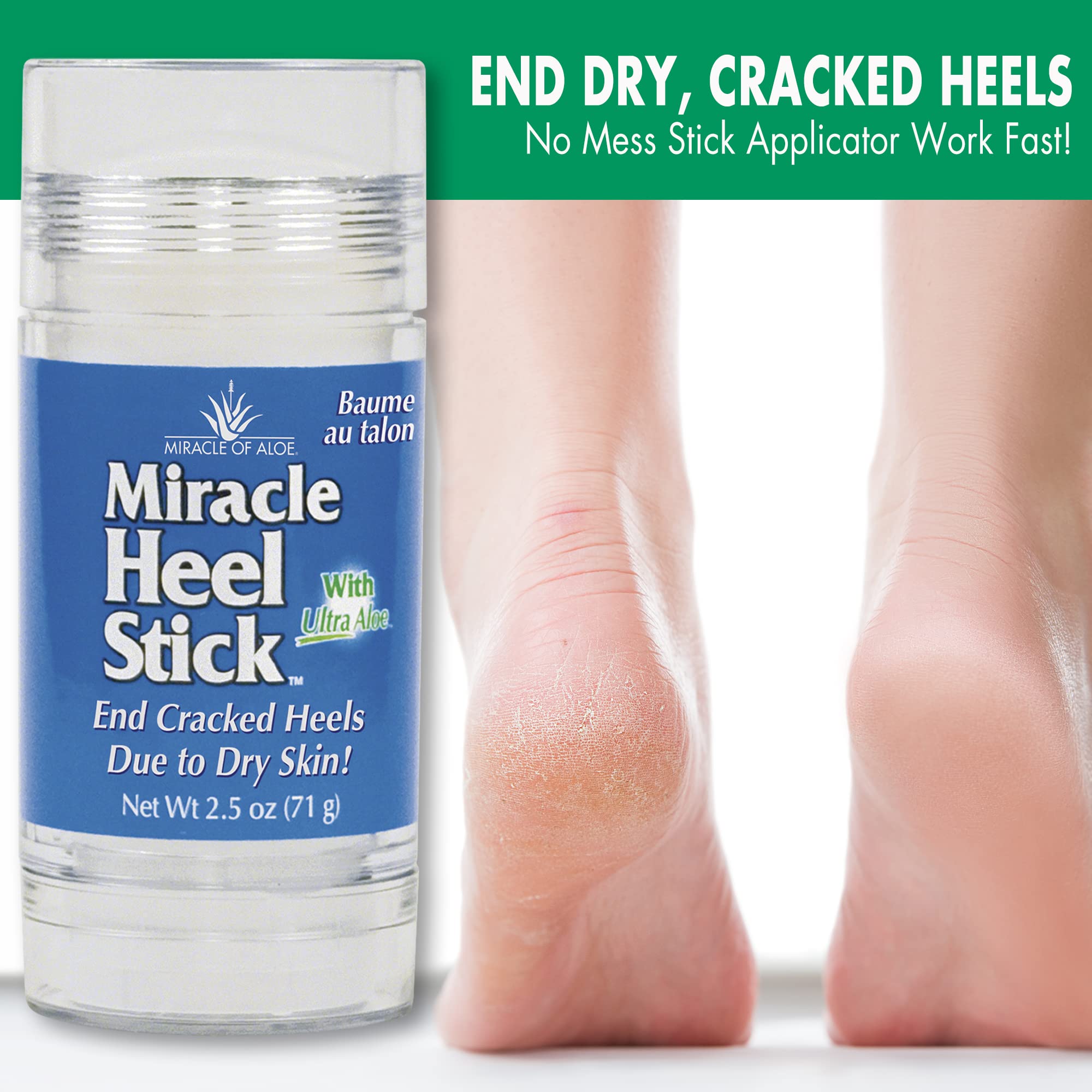 Miracle of Aloe Heel Stick – Dry Cracked Heel Balm (2.5 oz) with Pure Aloe Vera