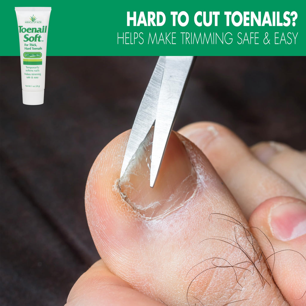 Miracle of Aloe Toenail Softener Cream – Fast-Acting, Non-Greasy, Safe for All Ages