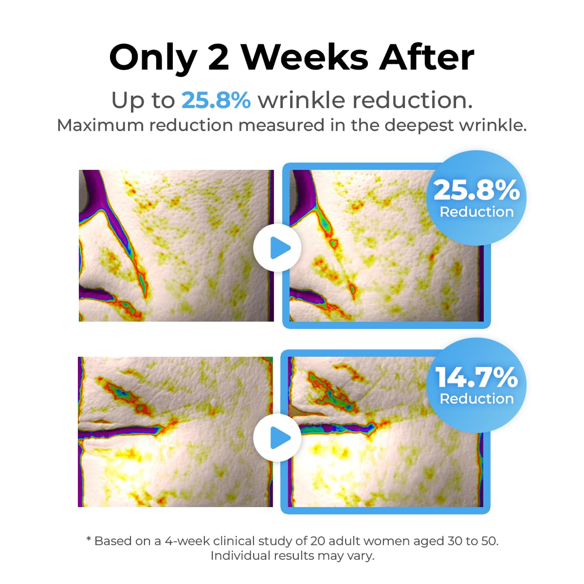 MISS MYER SNOW TOX WrinkleTreatment Serum – Instant Botox-Like Lift, Needle-Free Wrinkle Reduction, 30 ml
