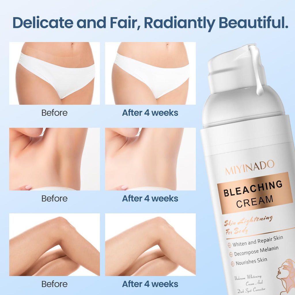 MIYINADO Skin Lightening Cream with Vitamin C - Dark Spot Remover for Underarms, Knees, Elbows & Bikini Line (50ml)
