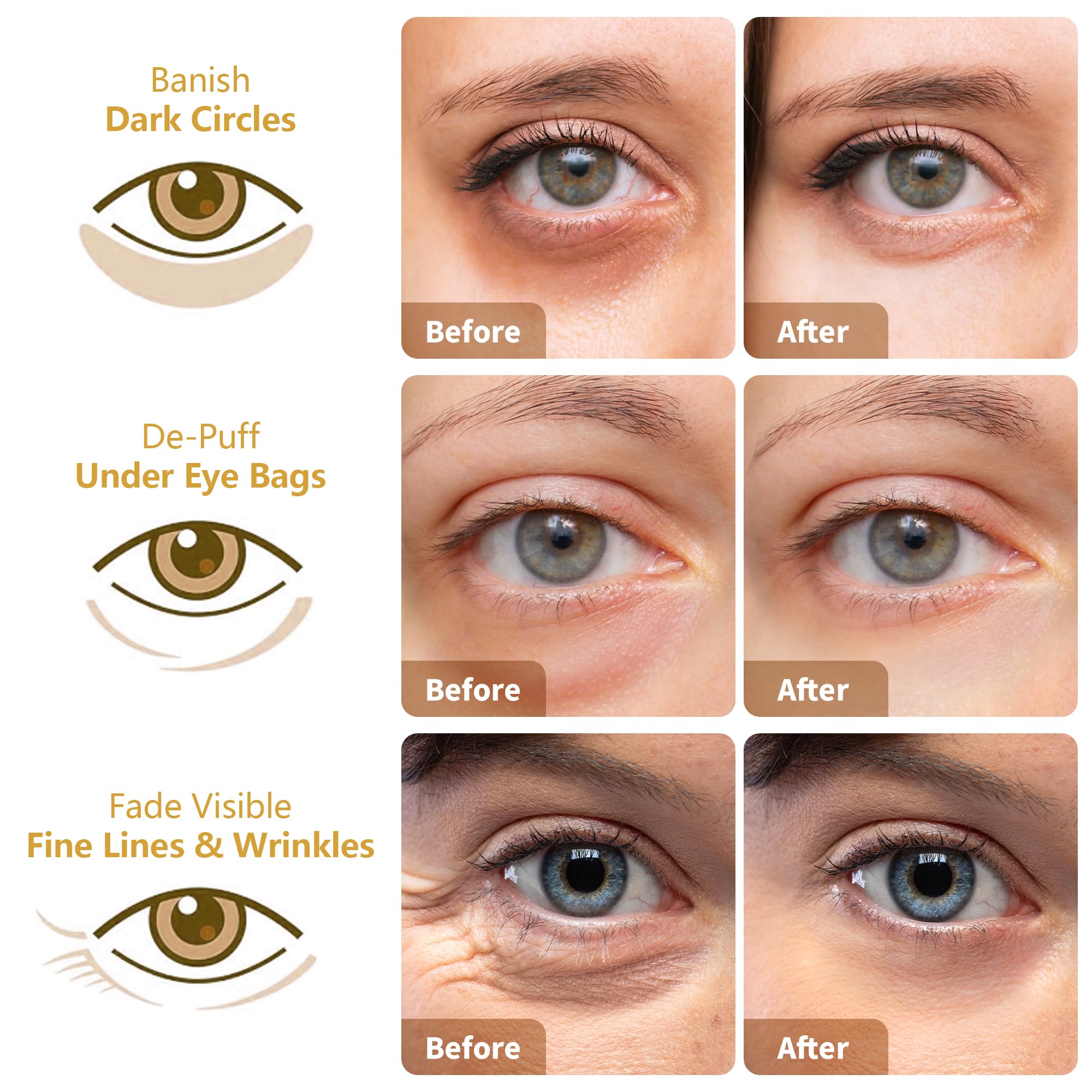 MLDWYH Under Eye Patches – 24K Gold, Hyaluronic Acid & Rose (30 Pairs)