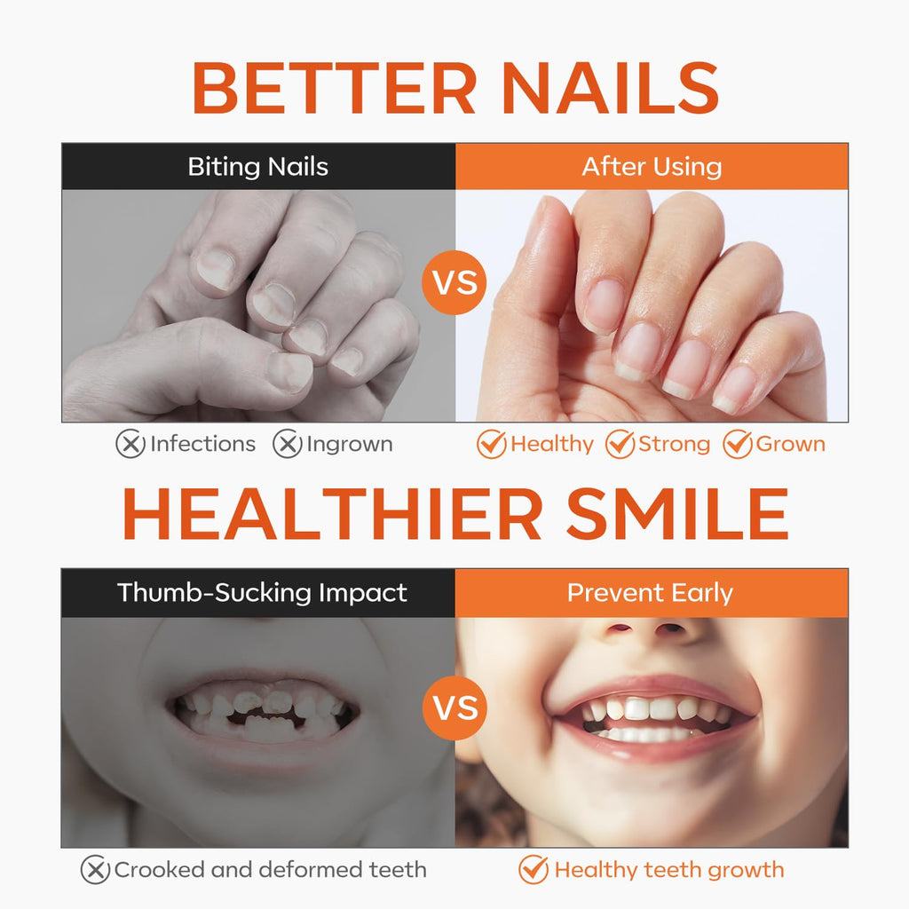 modelones Gel Nail Biting Treatment – Bitter Deterrent Nail Polish for Kids & Adults | Stop Nail Biting & Support Growth
