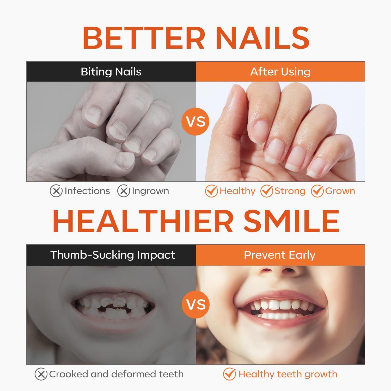 modelones Gel Nail Biting Treatment – Bitter Deterrent Nail Polish for Kids & Adults | Stop Nail Biting & Support Growth