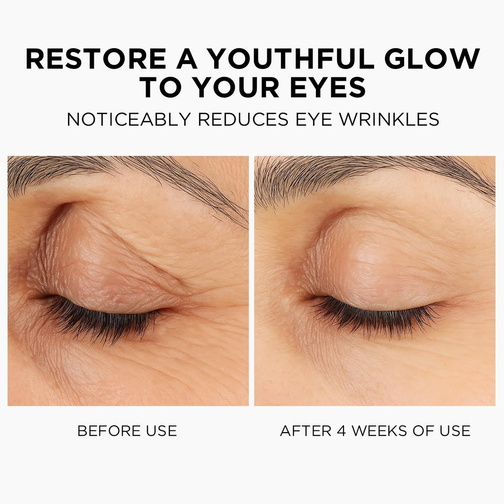 MOMOHOO Retinol Caffeine Under Eye Cream – Hydrating Anti-Aging with Soluble Collagen