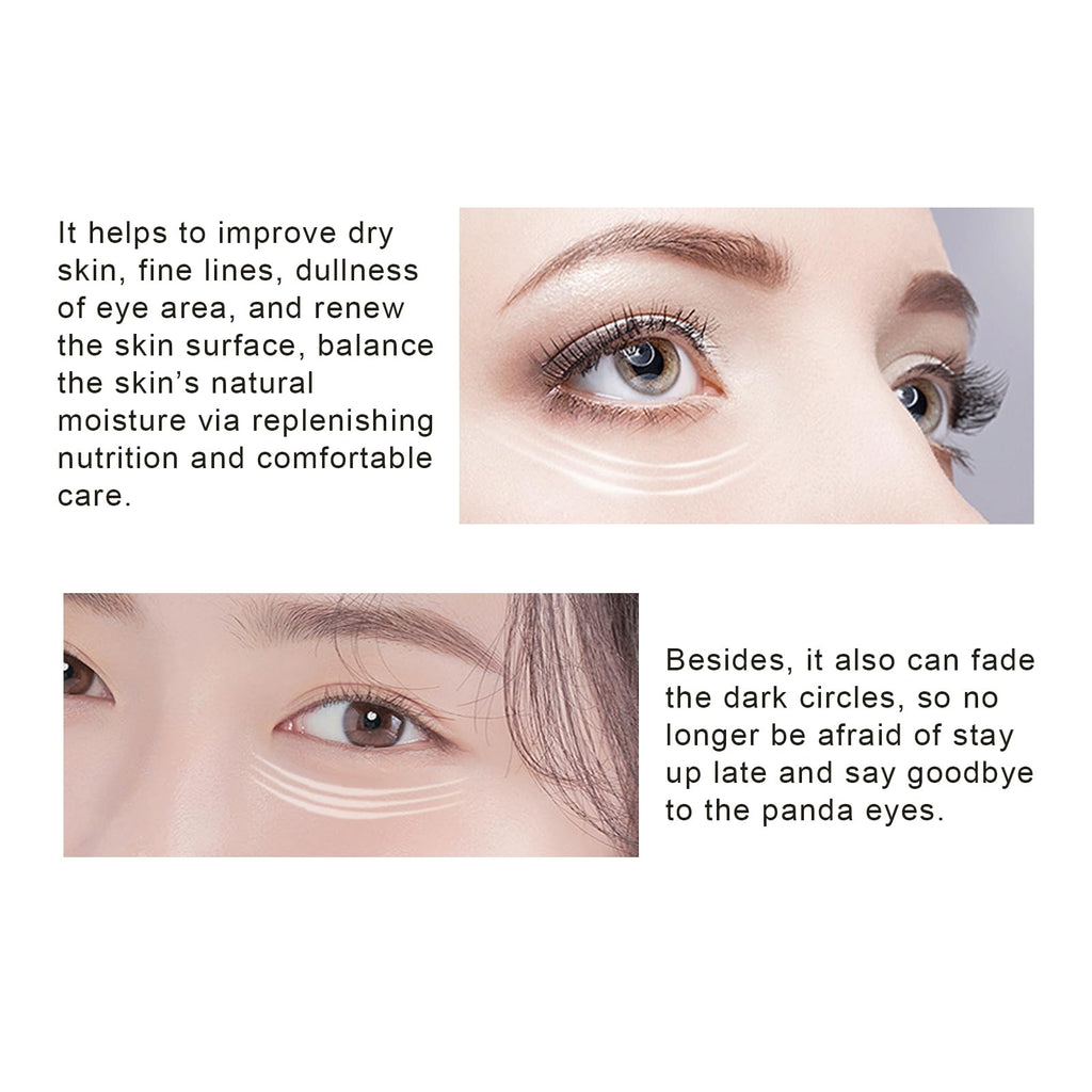 MOND'SUB Under Eye Patches – Hydration, Brightening & Puffiness Relief (20-Minute Treatment)