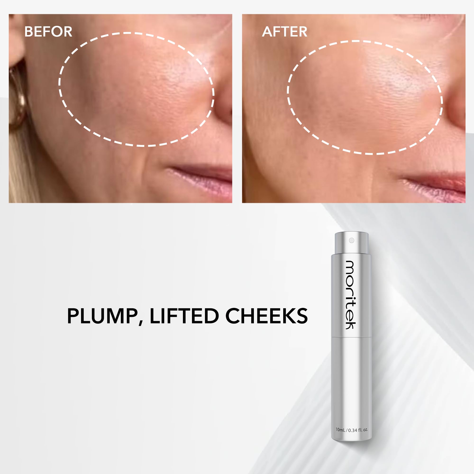 MORITEK Anti-Wrinkle & Lifting Essence Mist for Sensitive Skin – Hydrate, Firm, Brighten (10ml)