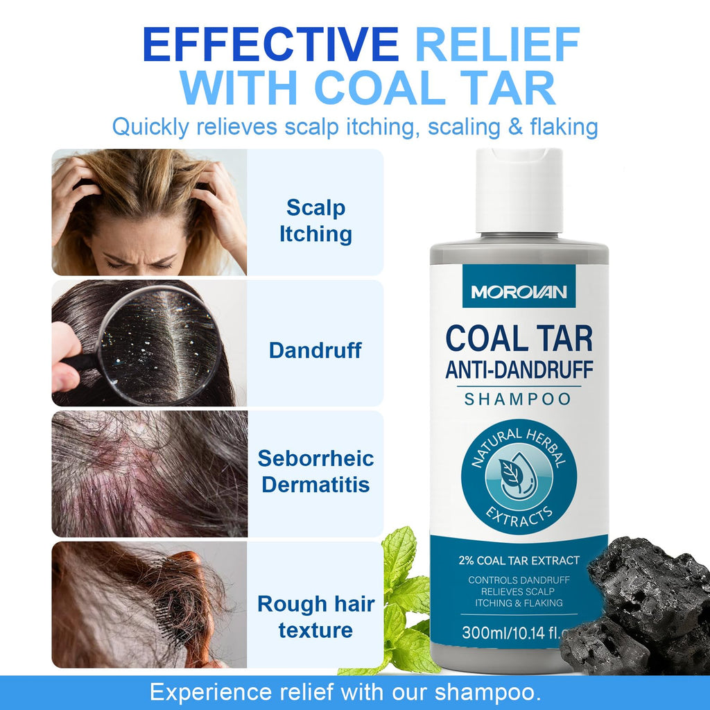 Morovan Coal Tar Shampoo 2%: Severe Dandruff & Itchy Scalp