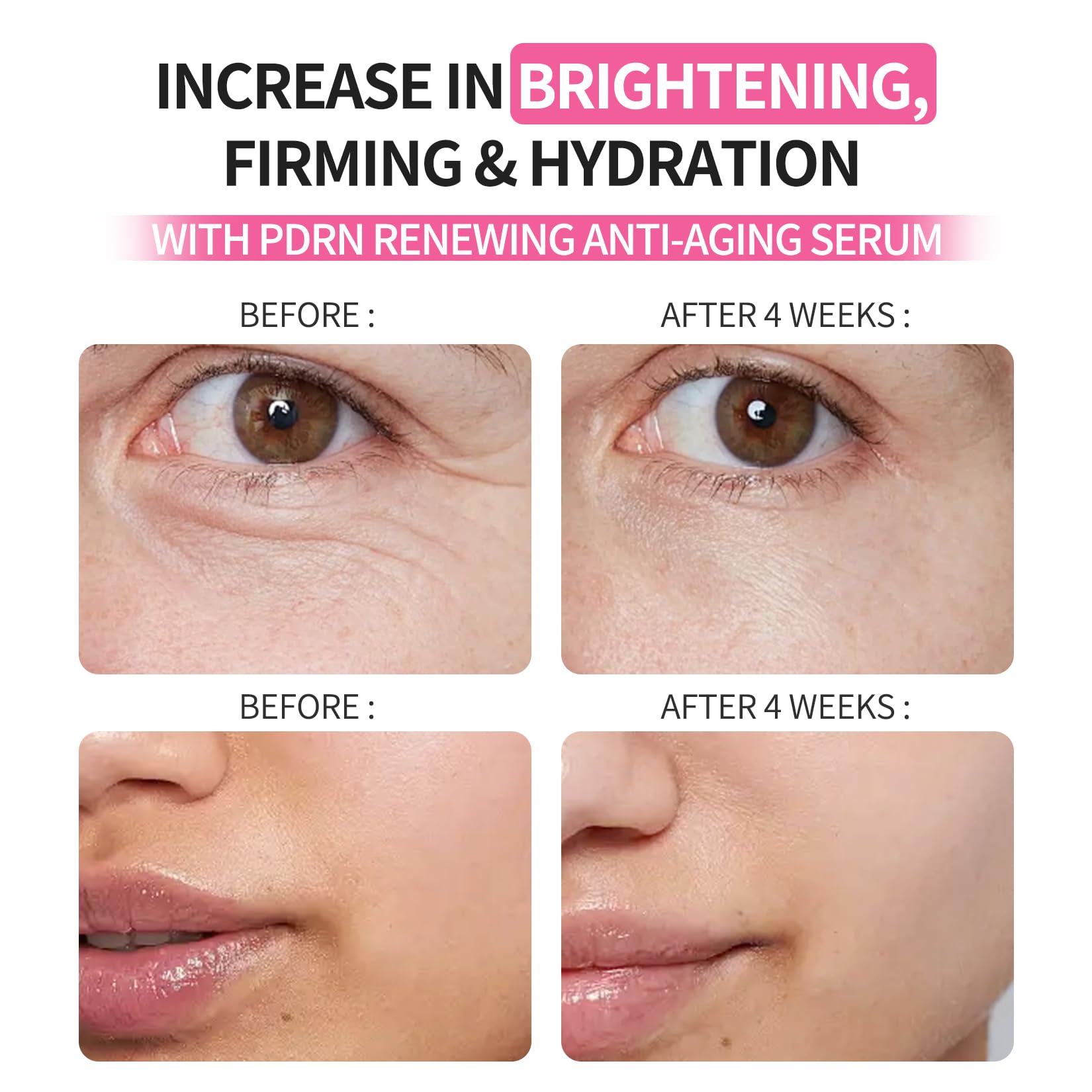 Morovan Salmon DNA Firming Serum – 99% PDRN Triple Concentrate for Wrinkles