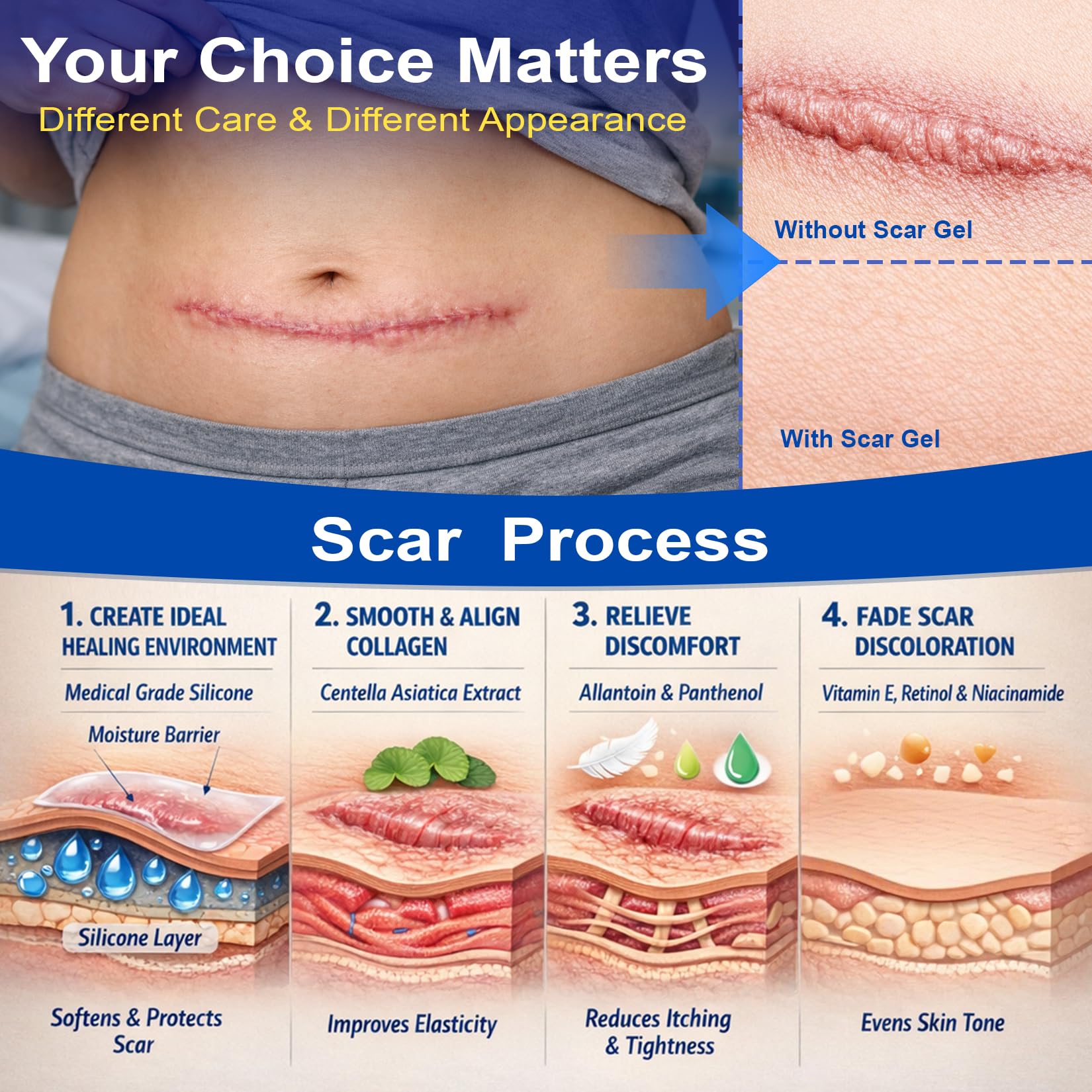 Morovan Silicone Scar Removal Gel | Minimize Visible Scars on Face & Body in as Little as 6 Weeks