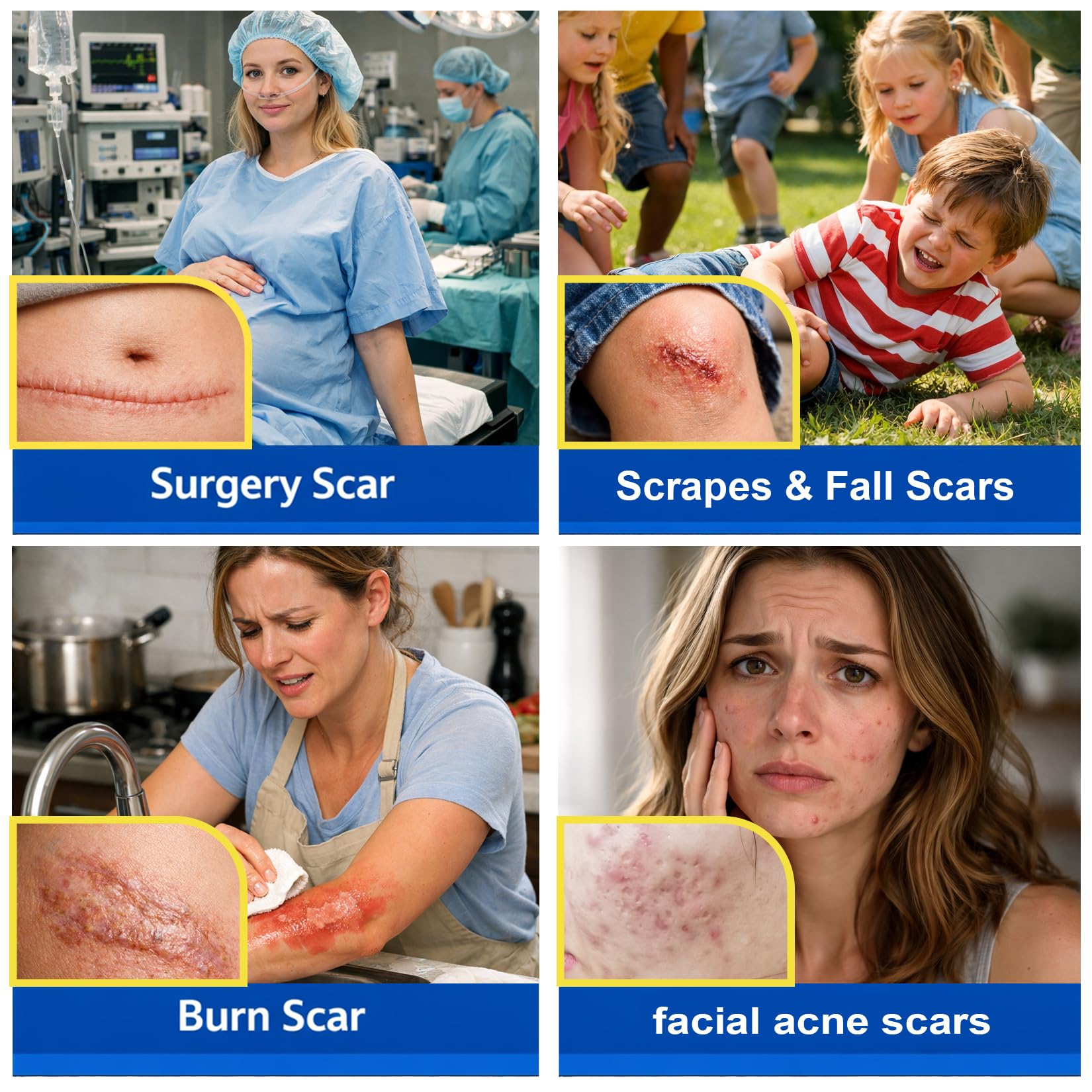 Morovan Silicone Scar Removal Gel | Minimize Visible Scars on Face & Body in as Little as 6 Weeks