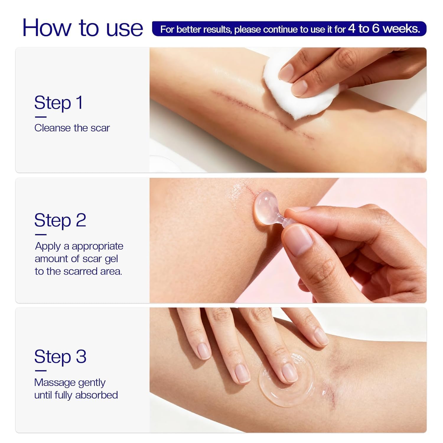 Morovan Silicone Scar Removal Gel | Minimize Visible Scars on Face & Body in as Little as 6 Weeks